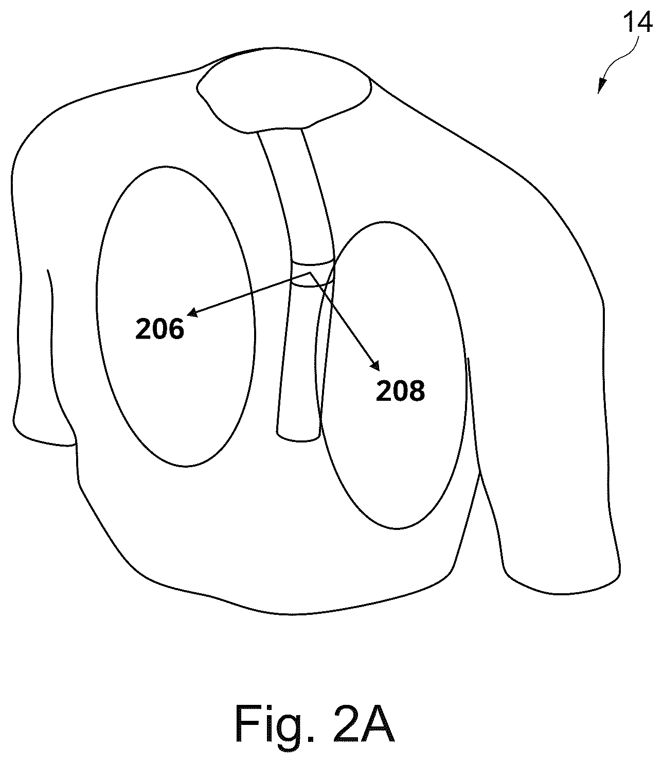 Patent US12102467 Figure 2 – Lung volume estimation from radiographic images