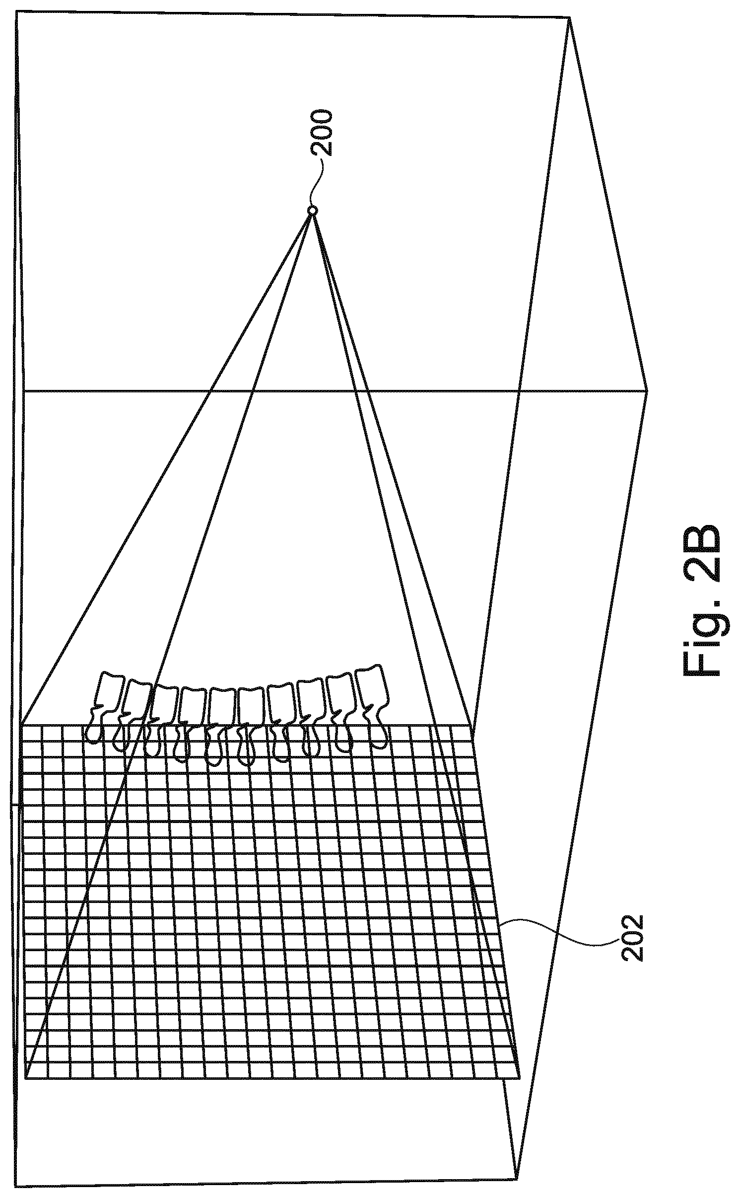 Patent US12102467 Figure 3 – Lung volume estimation from radiographic images