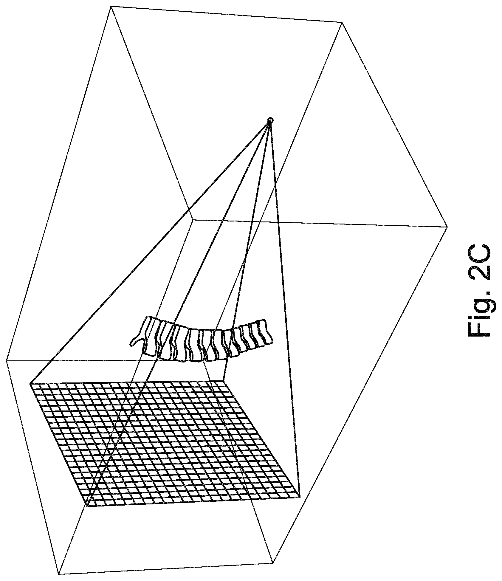 Patent US12102467 Figure 4 – Lung volume estimation from radiographic images