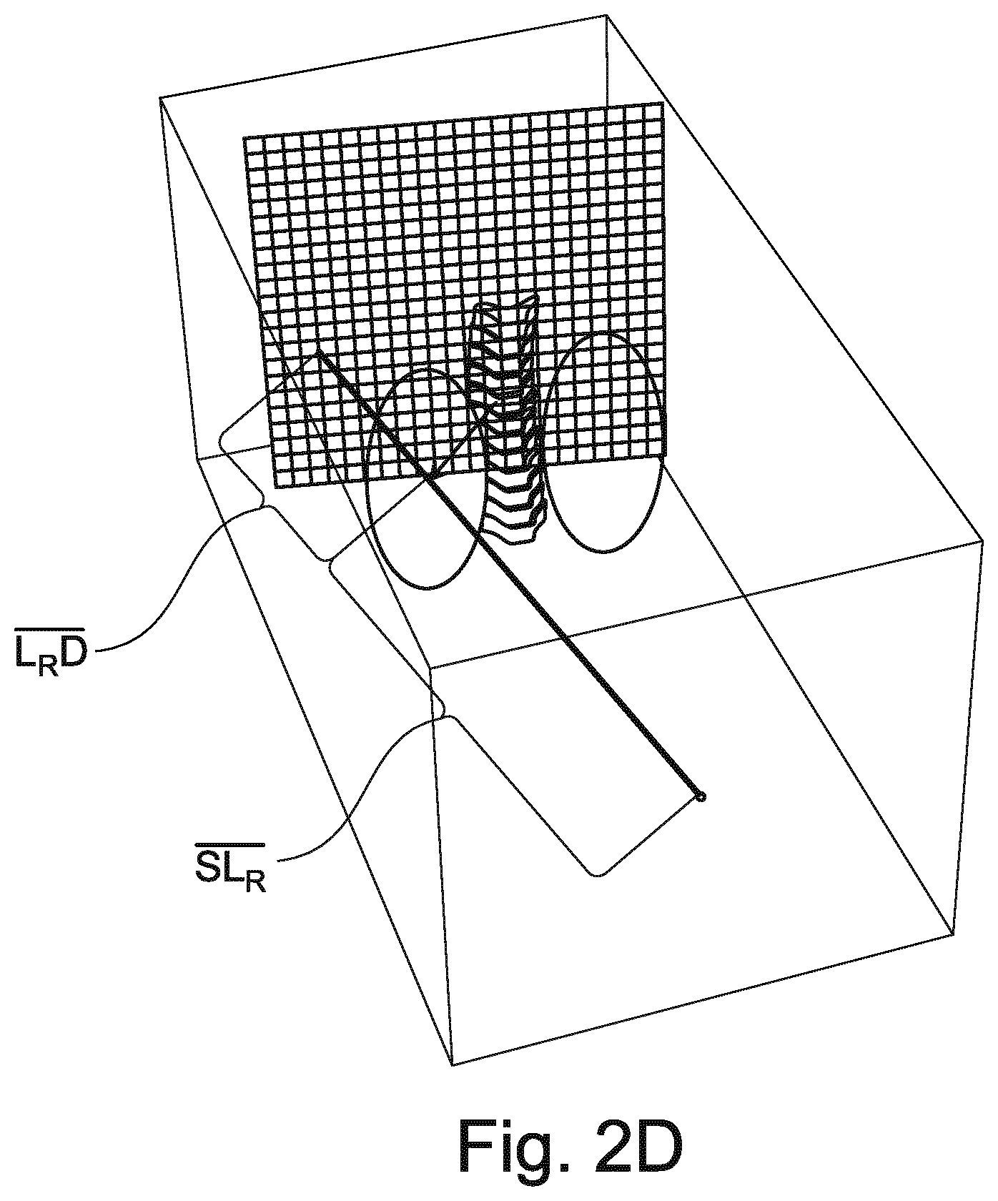 Patent US12102467 Figure 5 – Lung volume estimation from radiographic images