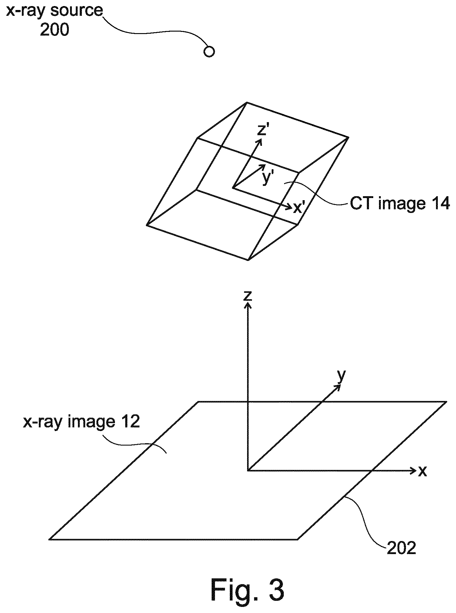Patent US12102467 Figure 8 – Lung volume estimation from radiographic images
