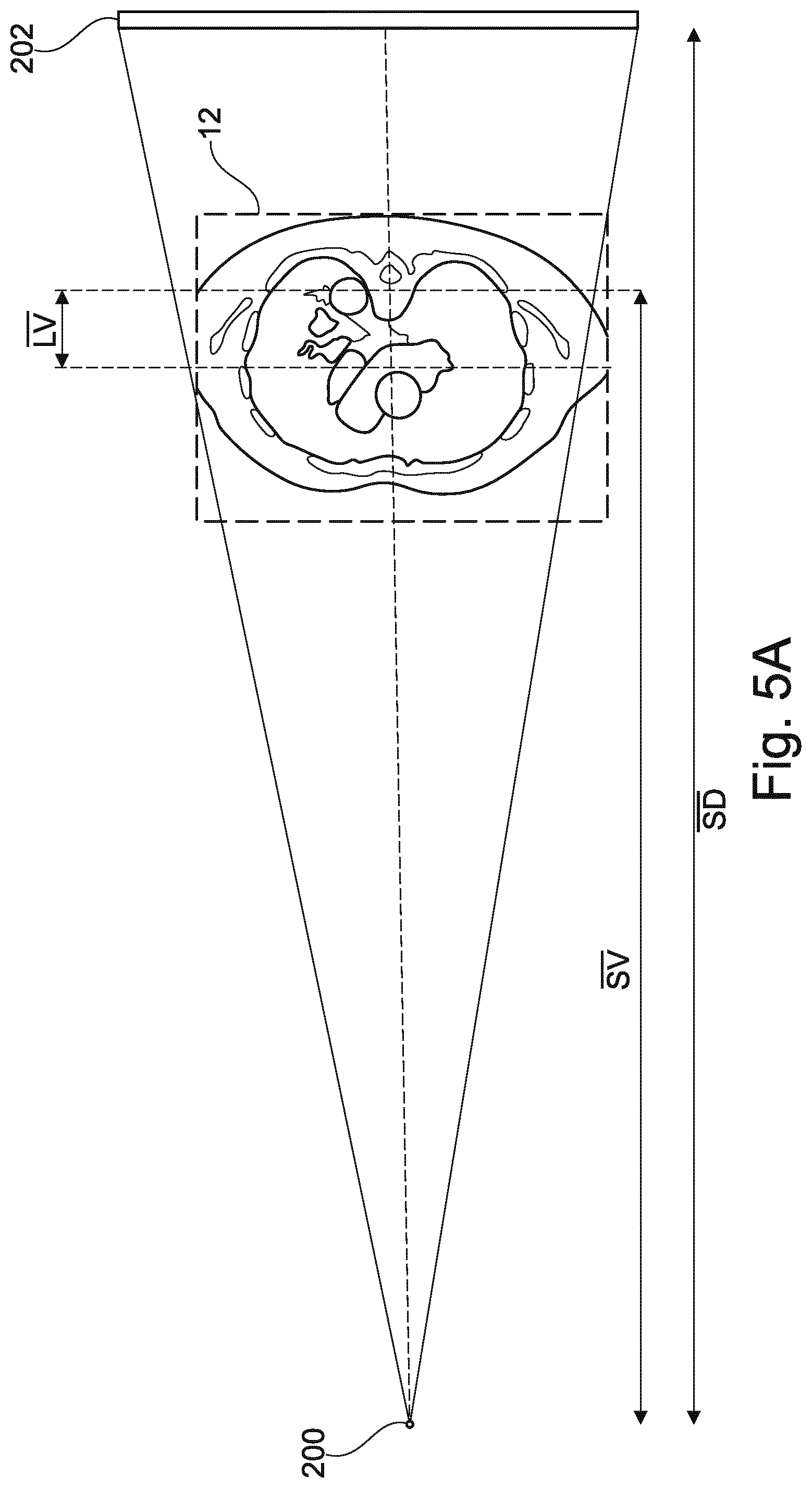 Patent US12102467 Figure 10 – Lung volume estimation from radiographic images