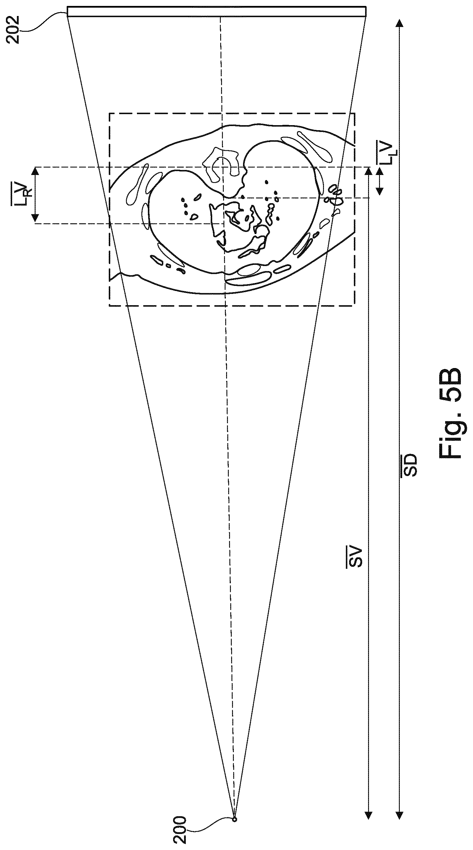 Patent US12102467 Figure 11 – Lung volume estimation from radiographic images