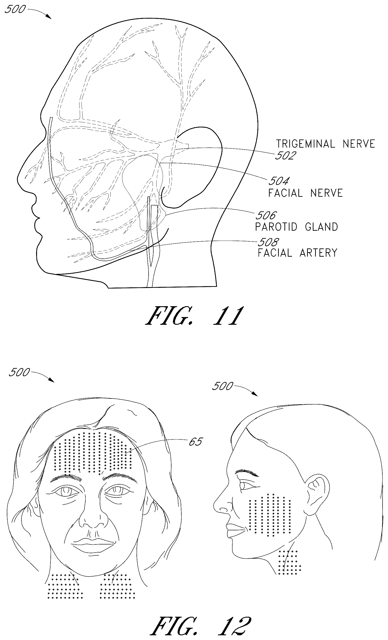 Patent US12102473 Figure 9 – Systems for ultrasound treatment
