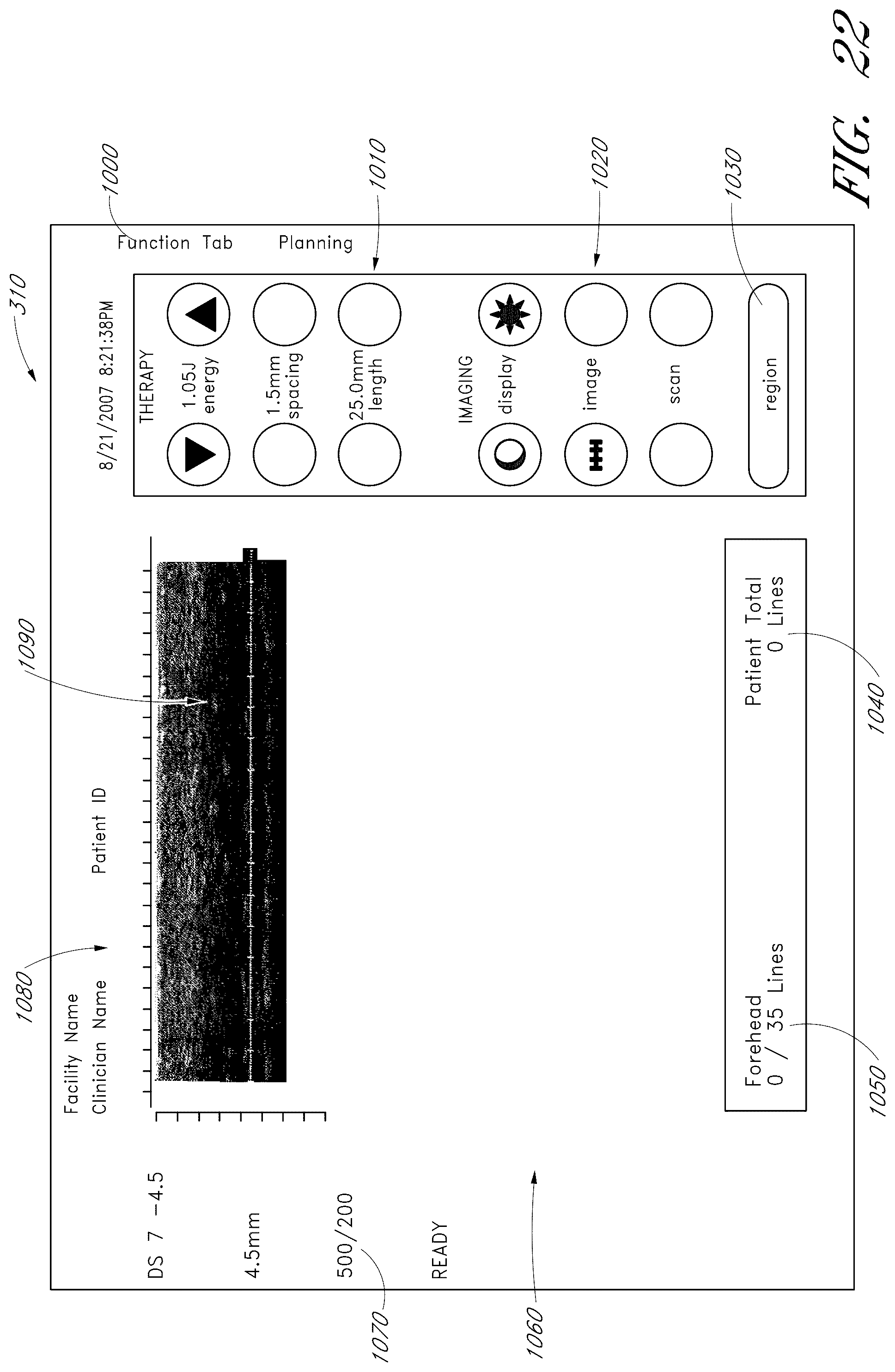 Patent US12102473 Figure 16 – Systems for ultrasound treatment