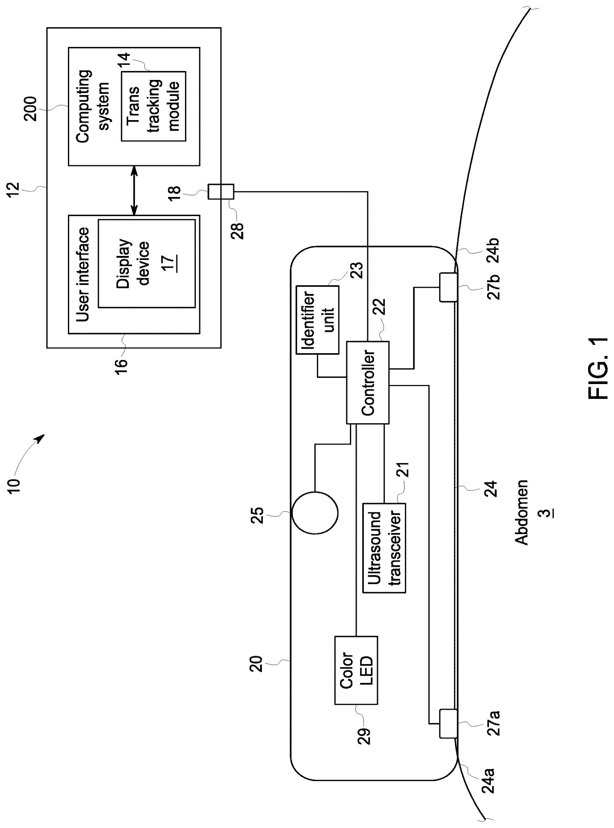 Patent US12102474 Figure 1 – Fetal ultrasound monitoring method and system