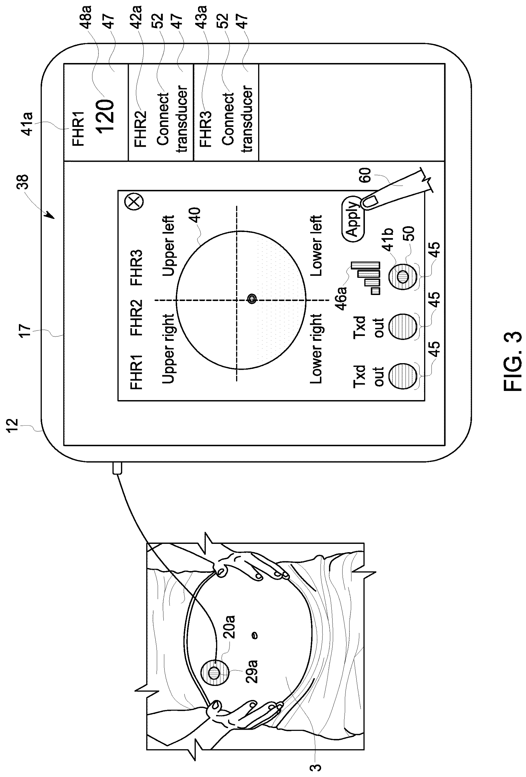 Patent US12102474 Figure 3 – Fetal ultrasound monitoring method and system