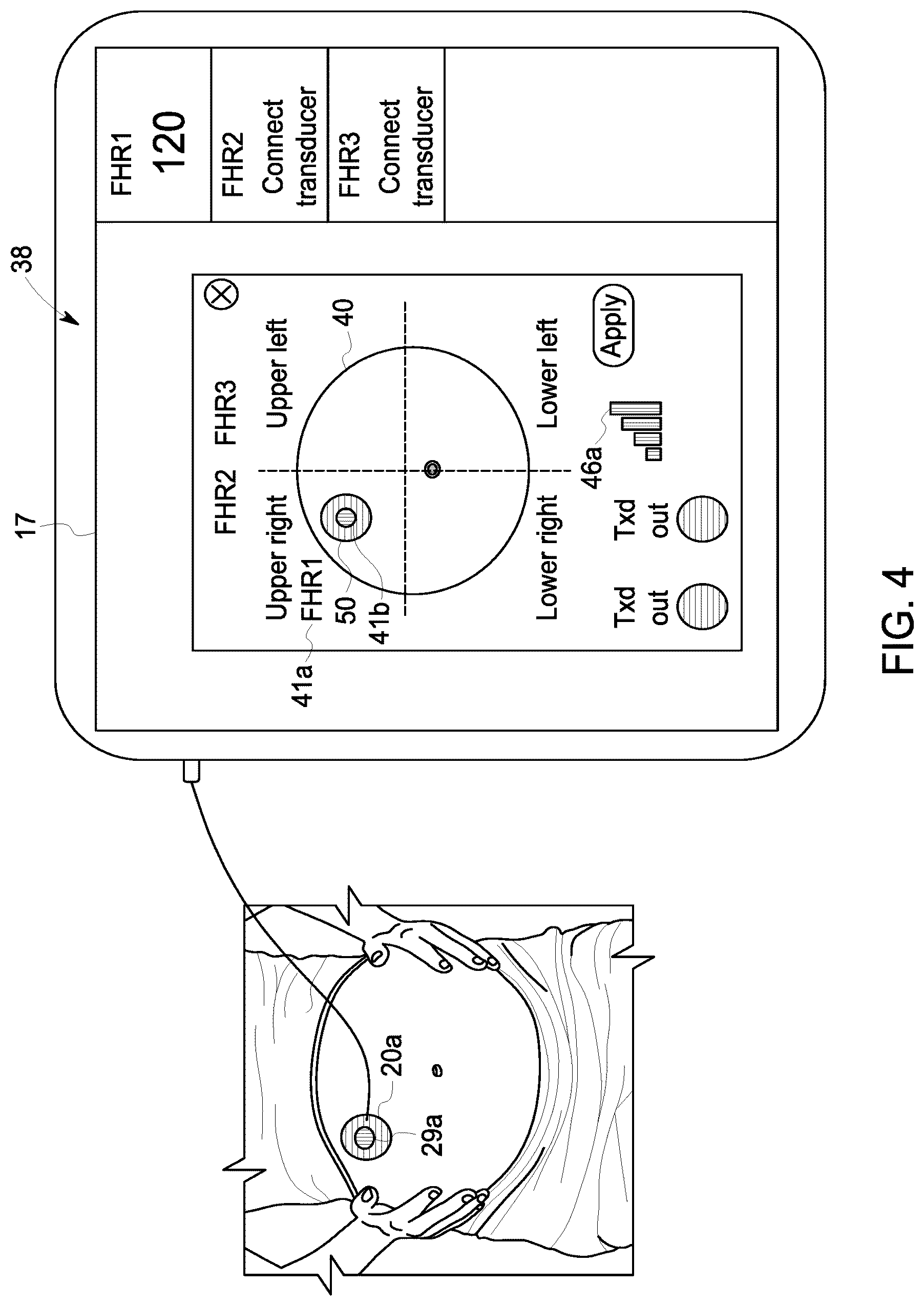 Patent US12102474 Figure 4 – Fetal ultrasound monitoring method and system