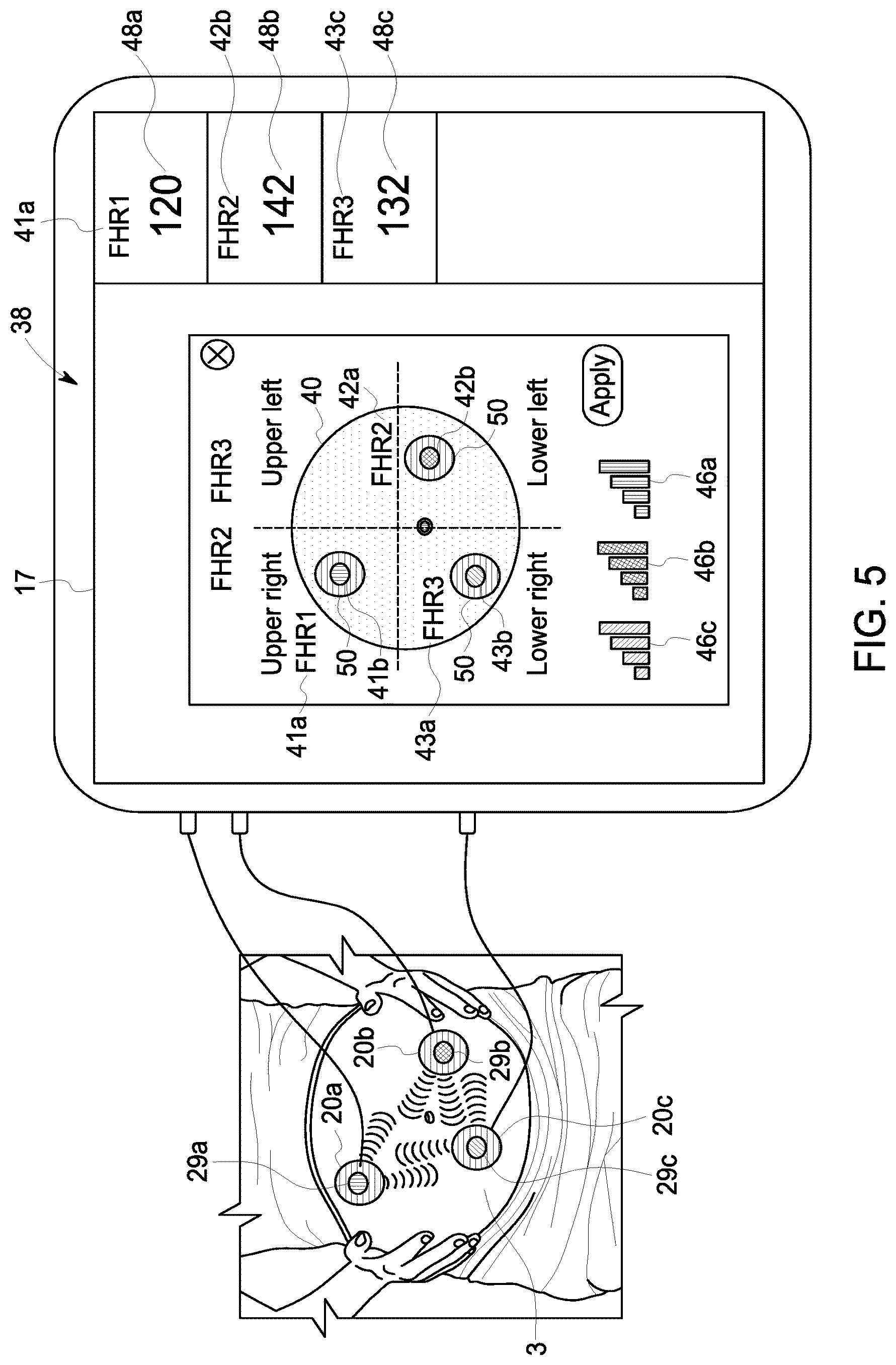 Patent US12102474 Figure 5 – Fetal ultrasound monitoring method and system