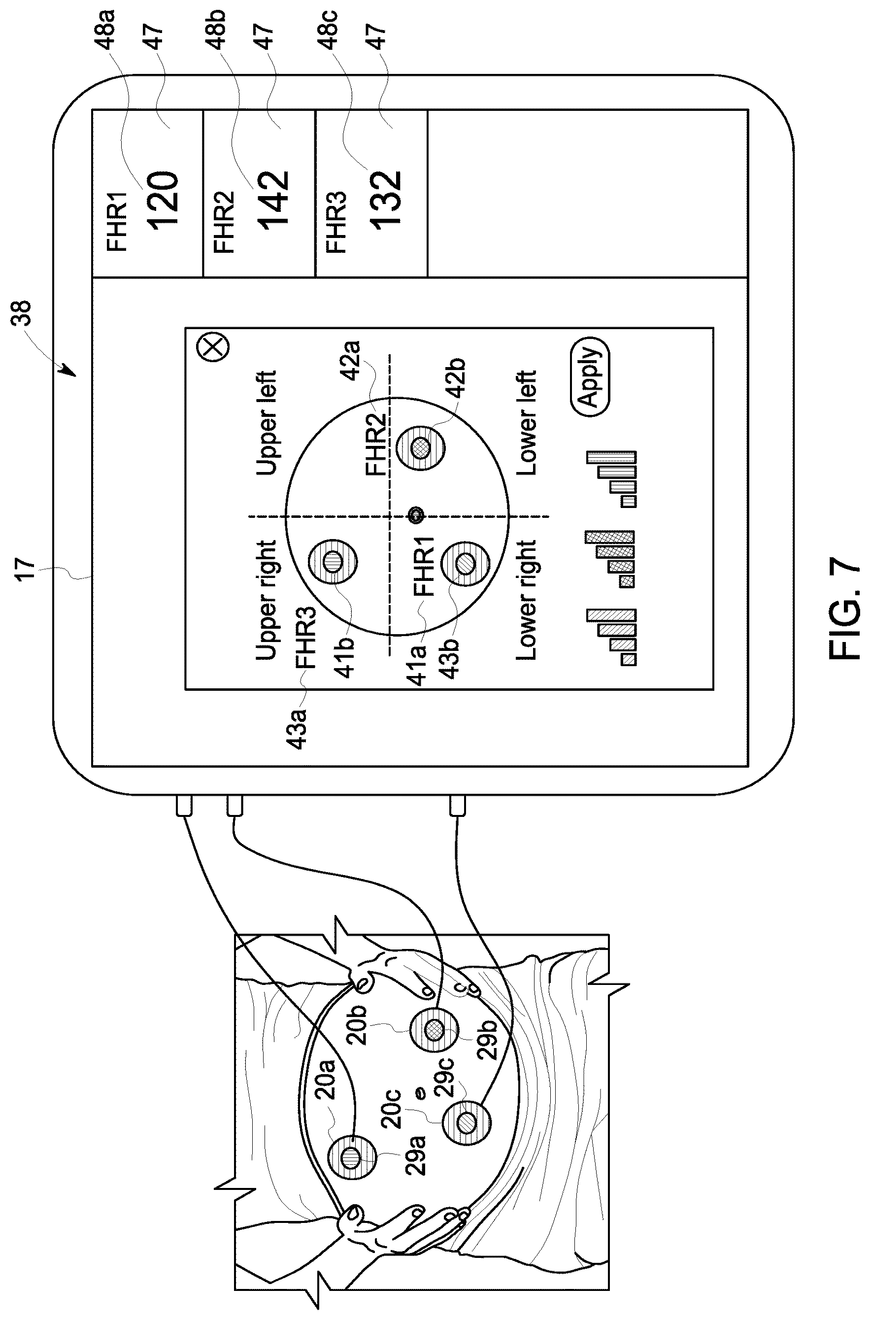 Patent US12102474 Figure 7 – Fetal ultrasound monitoring method and system