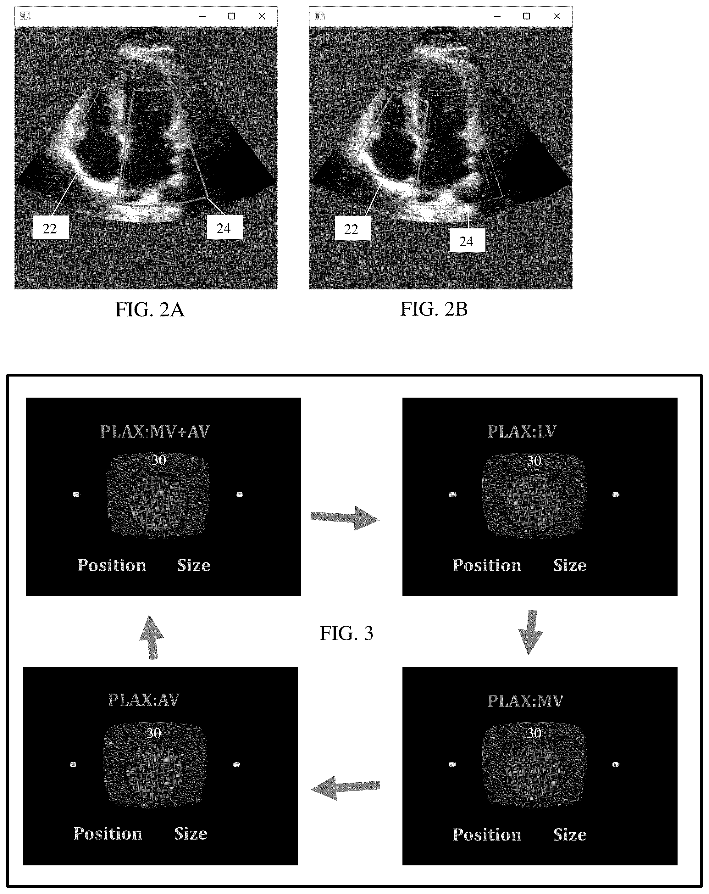 Patent US12102475 Figure 2 – Image classification-dependent user interface in ultrasound imaging