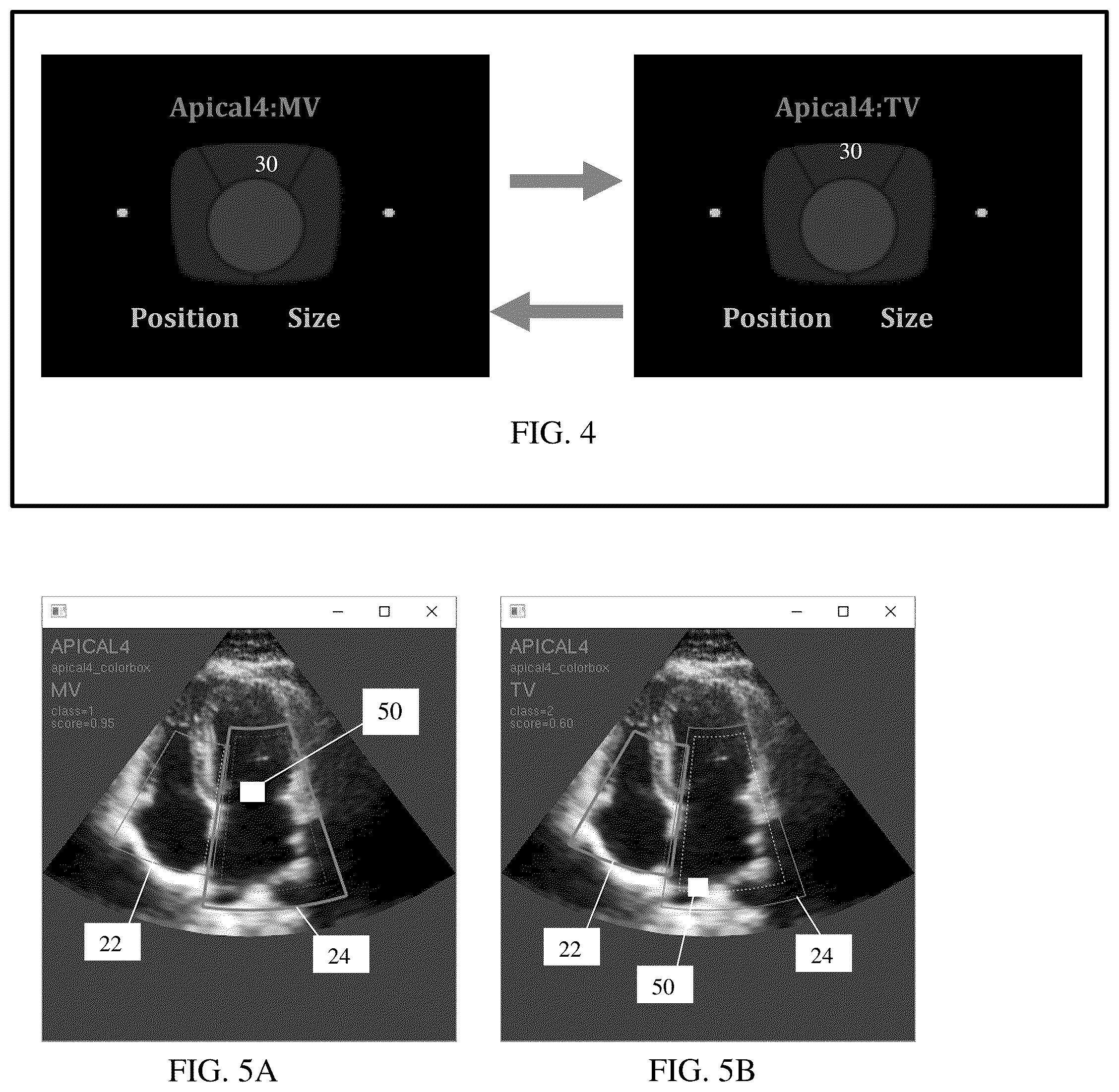 Patent US12102475 Figure 3 – Image classification-dependent user interface in ultrasound imaging