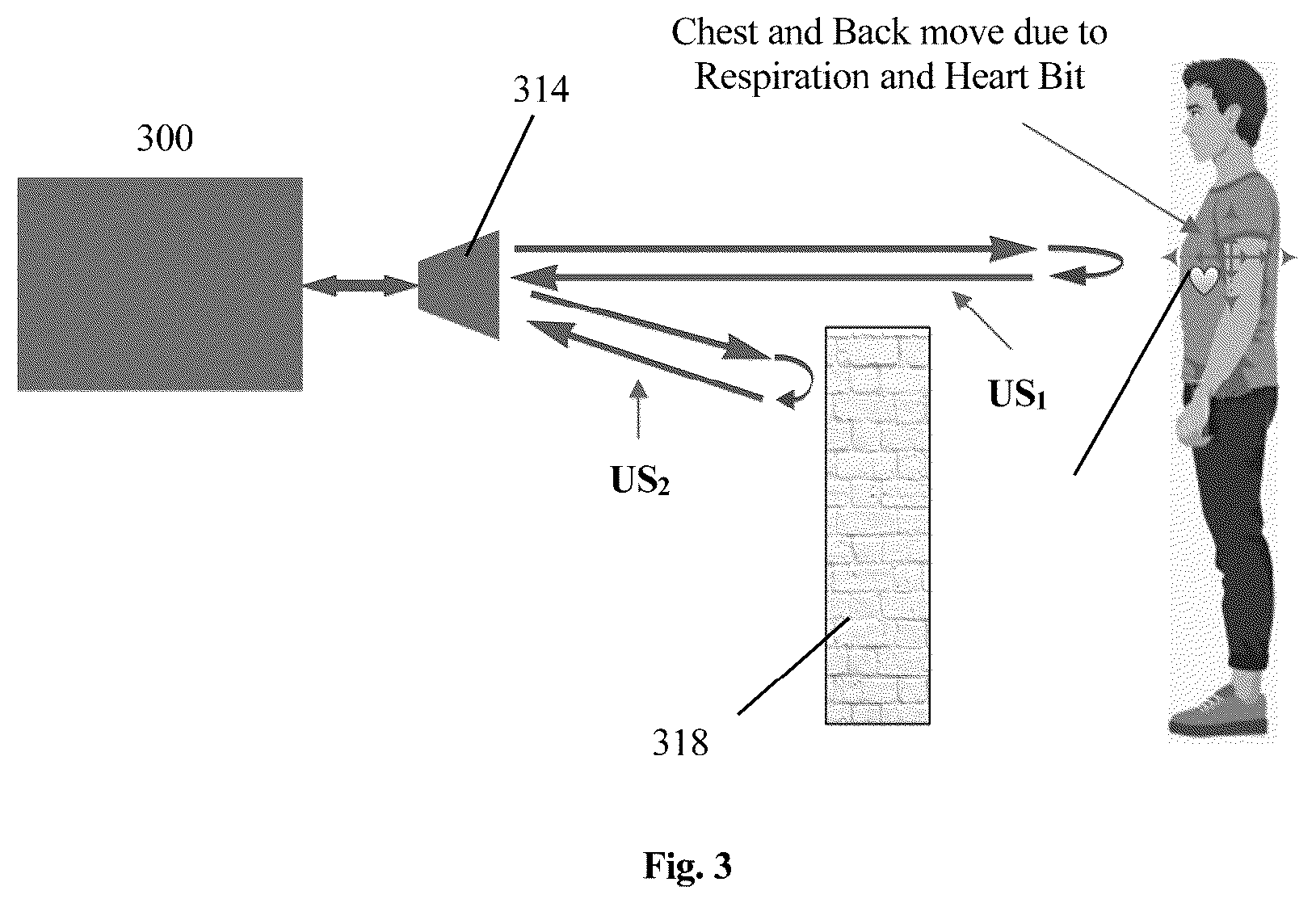 Patent US12102476 Figure 4 – Contact-free acoustic monitoring and measurement system