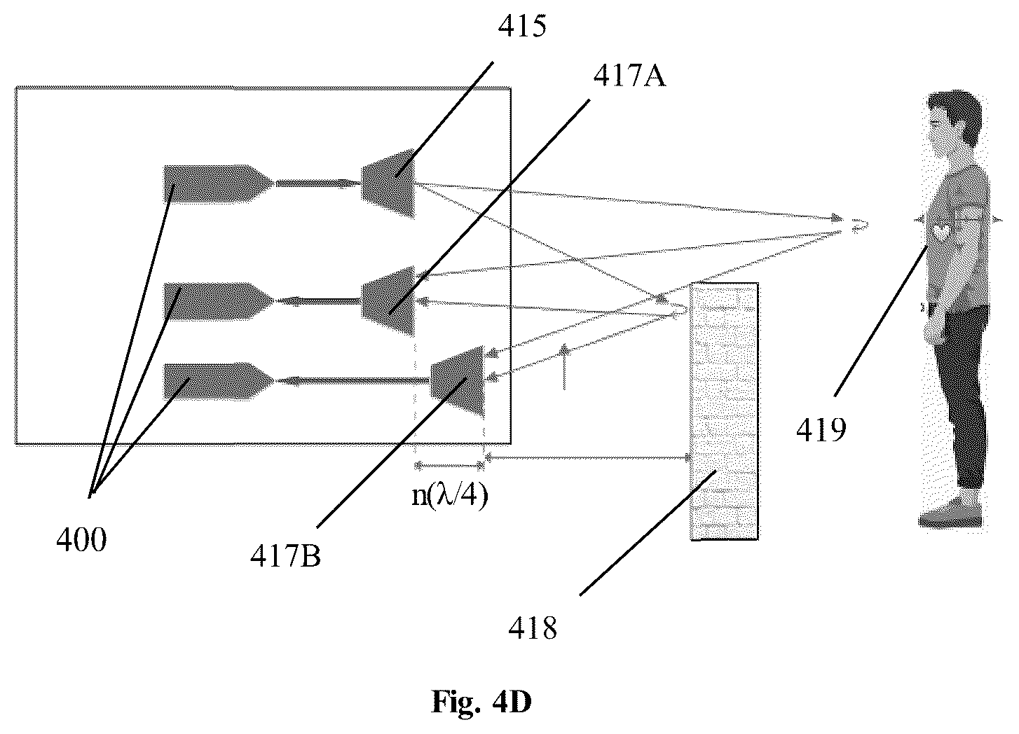 Patent US12102476 Figure 8 – Contact-free acoustic monitoring and measurement system
