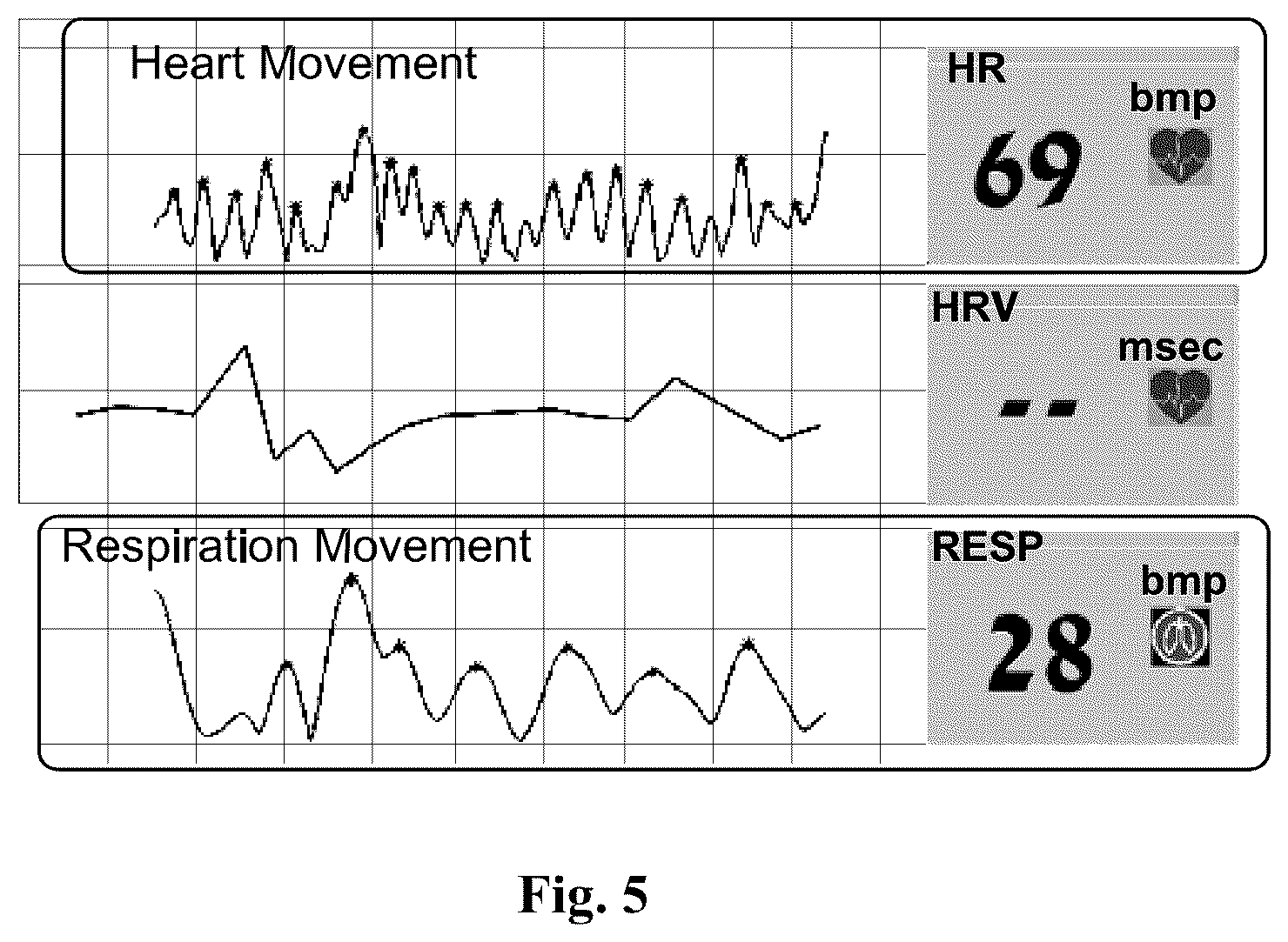 Patent US12102476 Figure 9 – Contact-free acoustic monitoring and measurement system