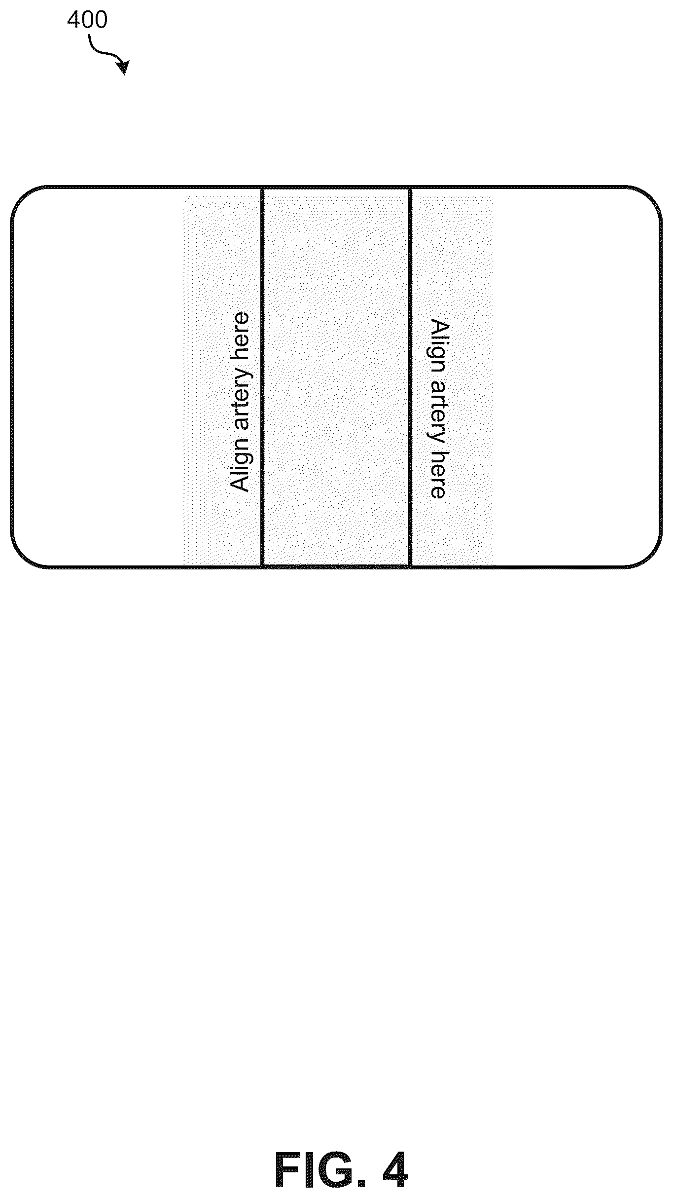 Patent US12102477 Figure 4 – Ultrasound measurement device