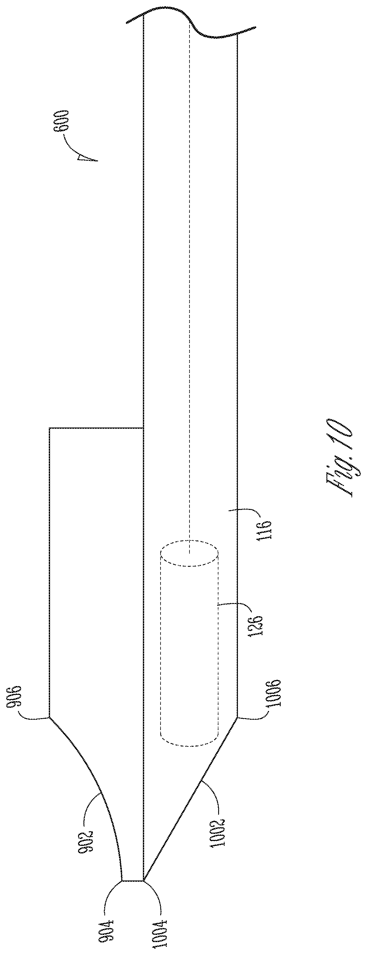 Patent US12102478 Figure 15 – User-attachable/detachable imaging catheter