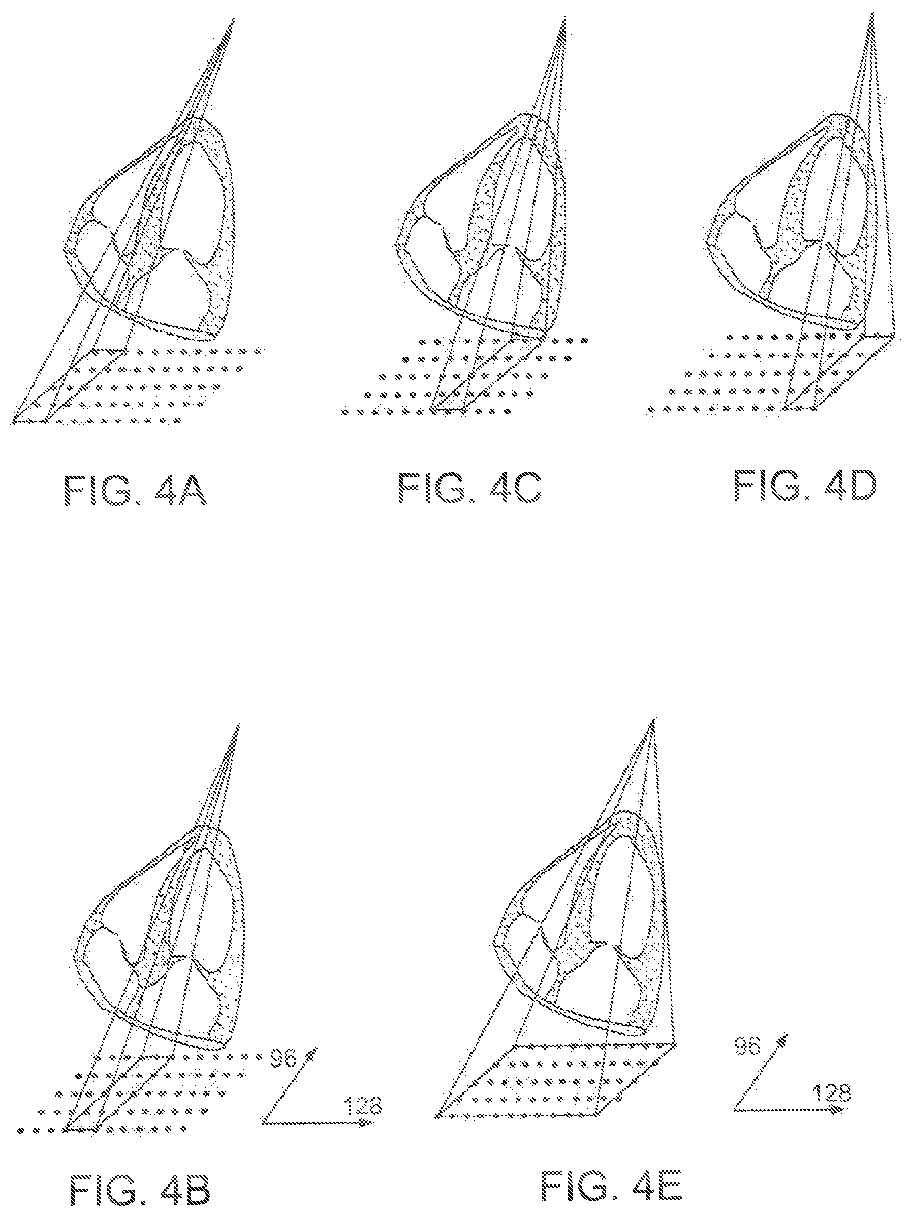 Patent US12102479 Figure 13 – Ultrasound 3D imaging system