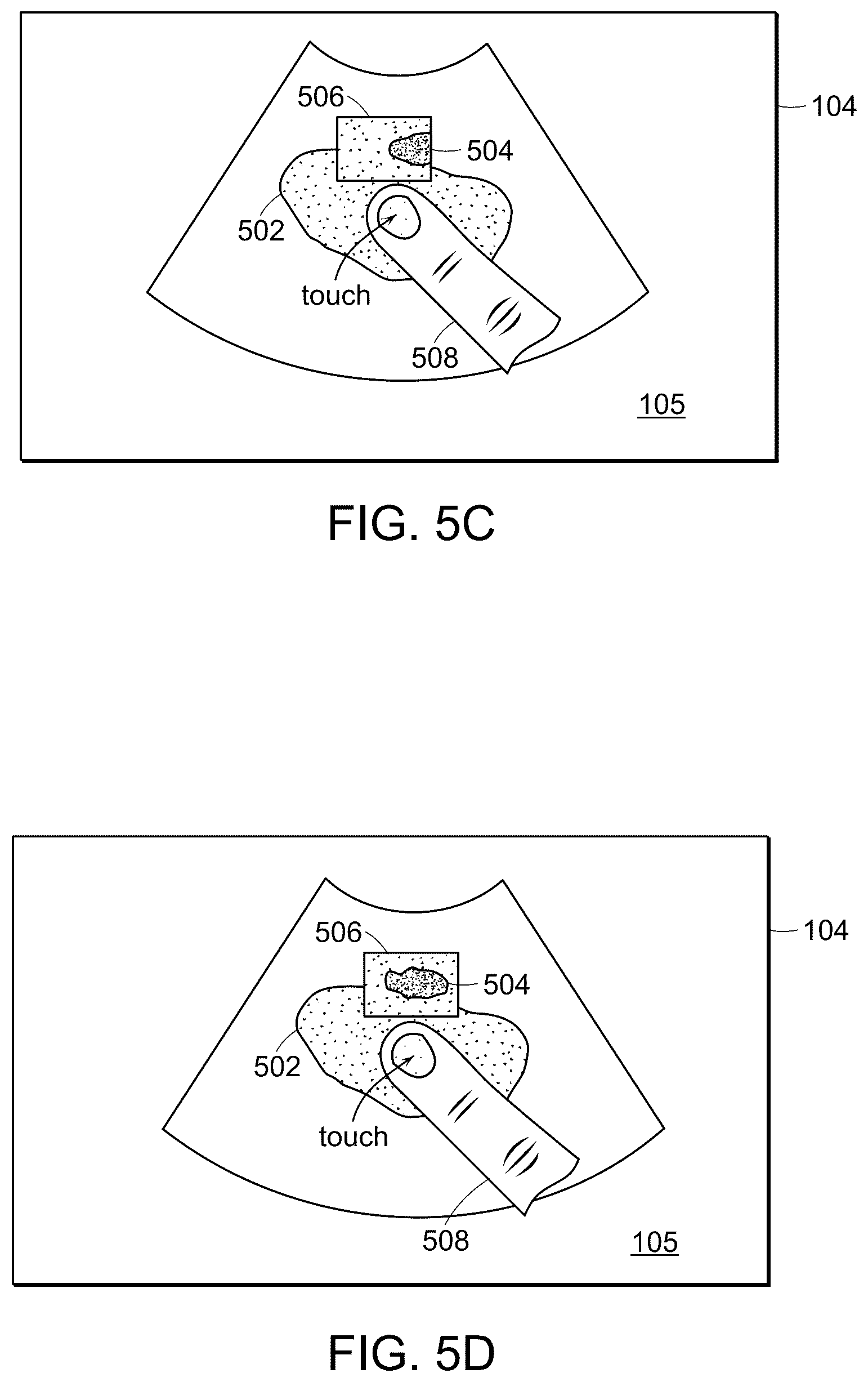 Patent US12102480 Figure 9 – Tablet ultrasound system