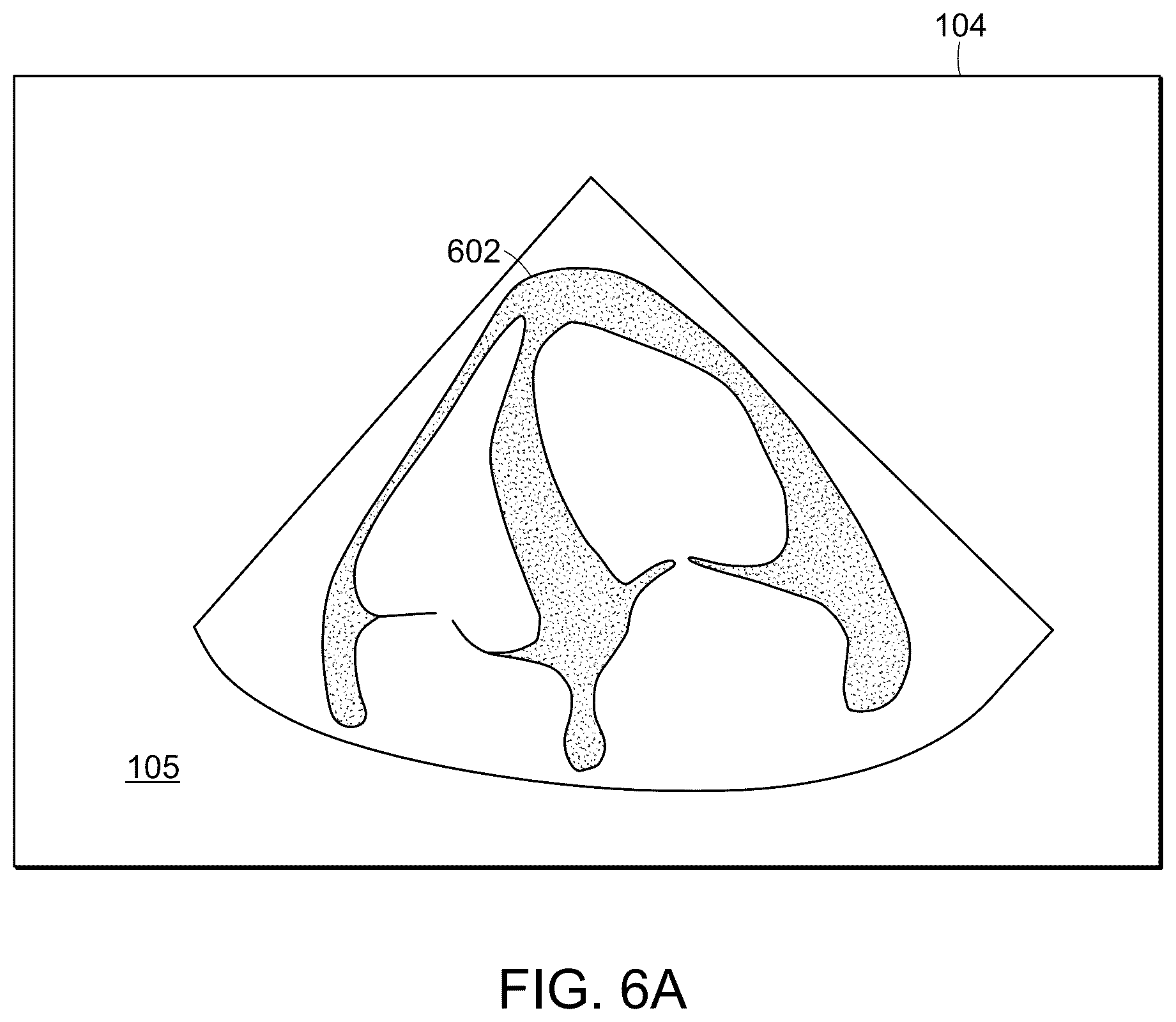 Patent US12102480 Figure 10 – Tablet ultrasound system