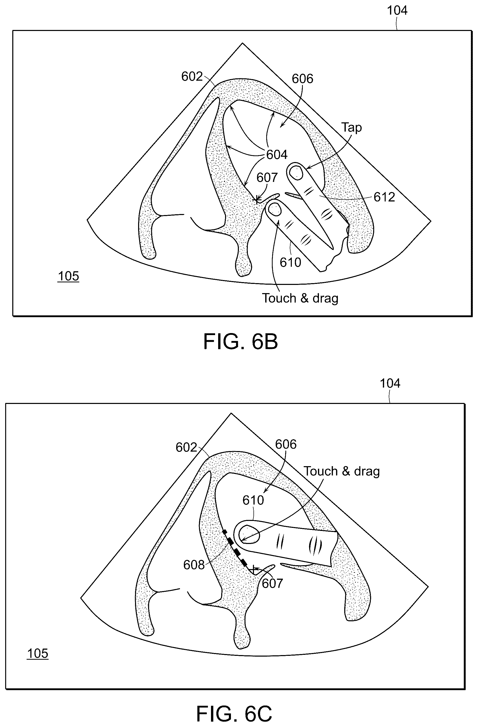 Patent US12102480 Figure 11 – Tablet ultrasound system