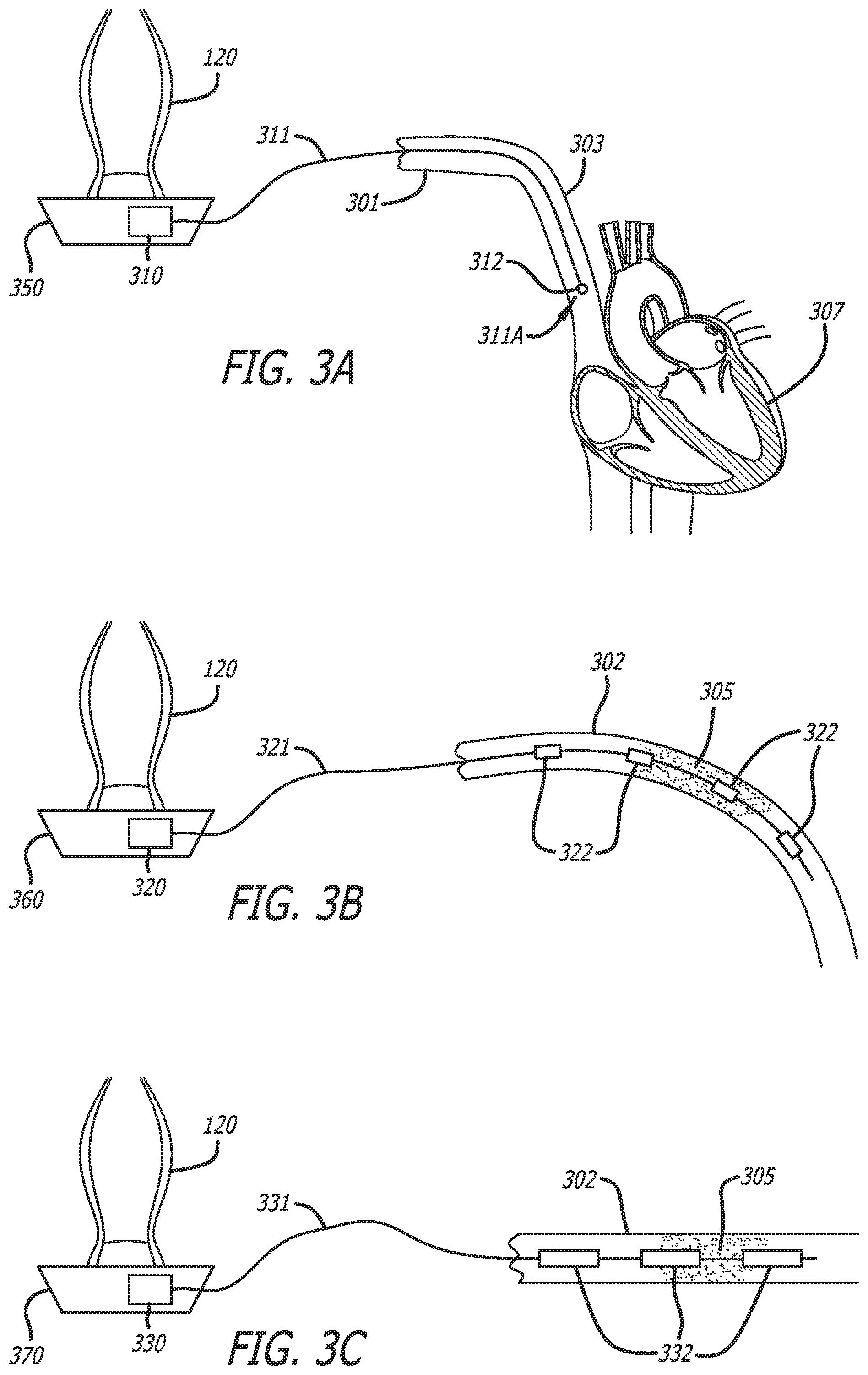 Patent US12102481 Figure 3 – Ultrasound probe with smart accessory
