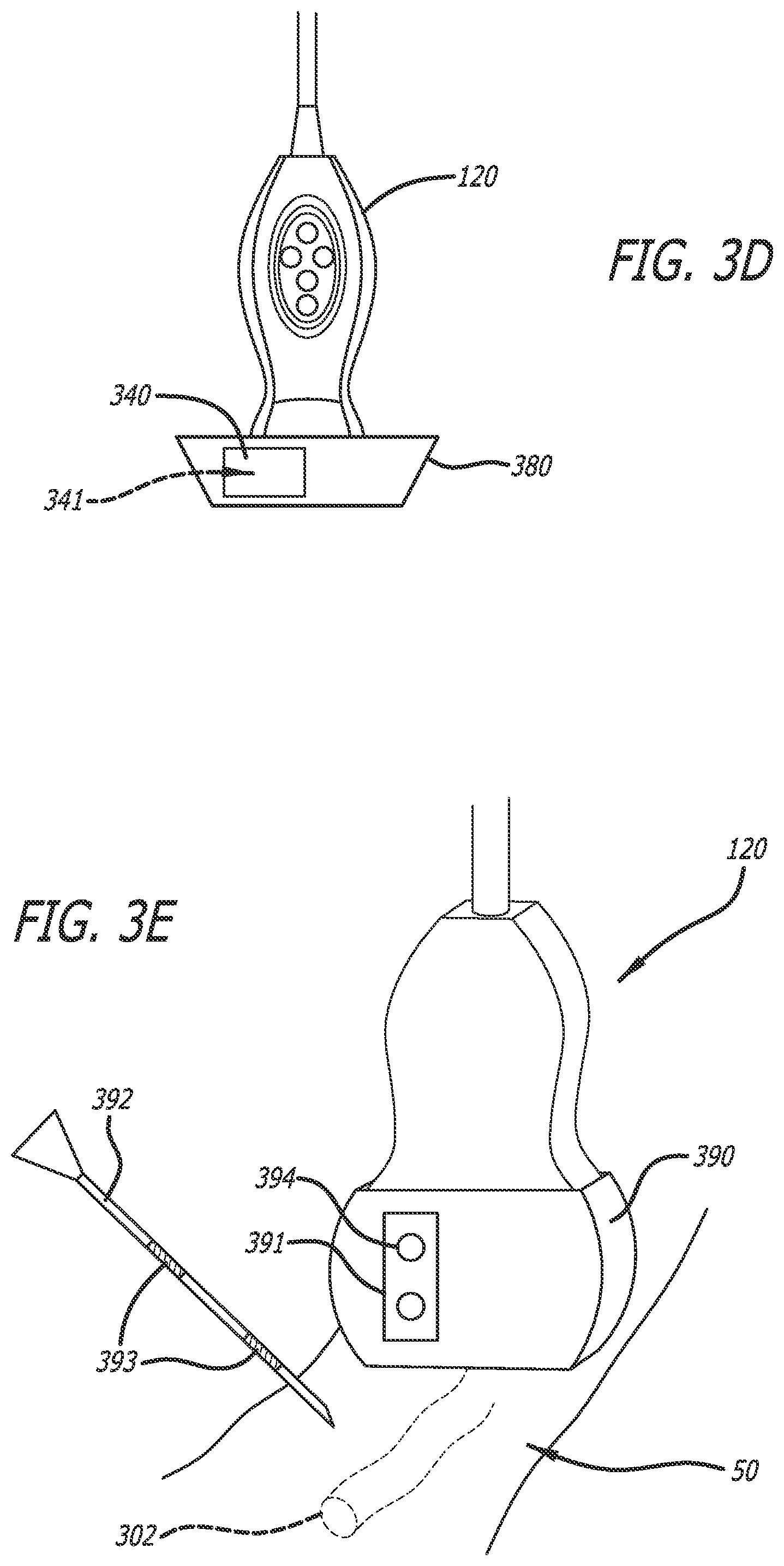 Patent US12102481 Figure 4 – Ultrasound probe with smart accessory