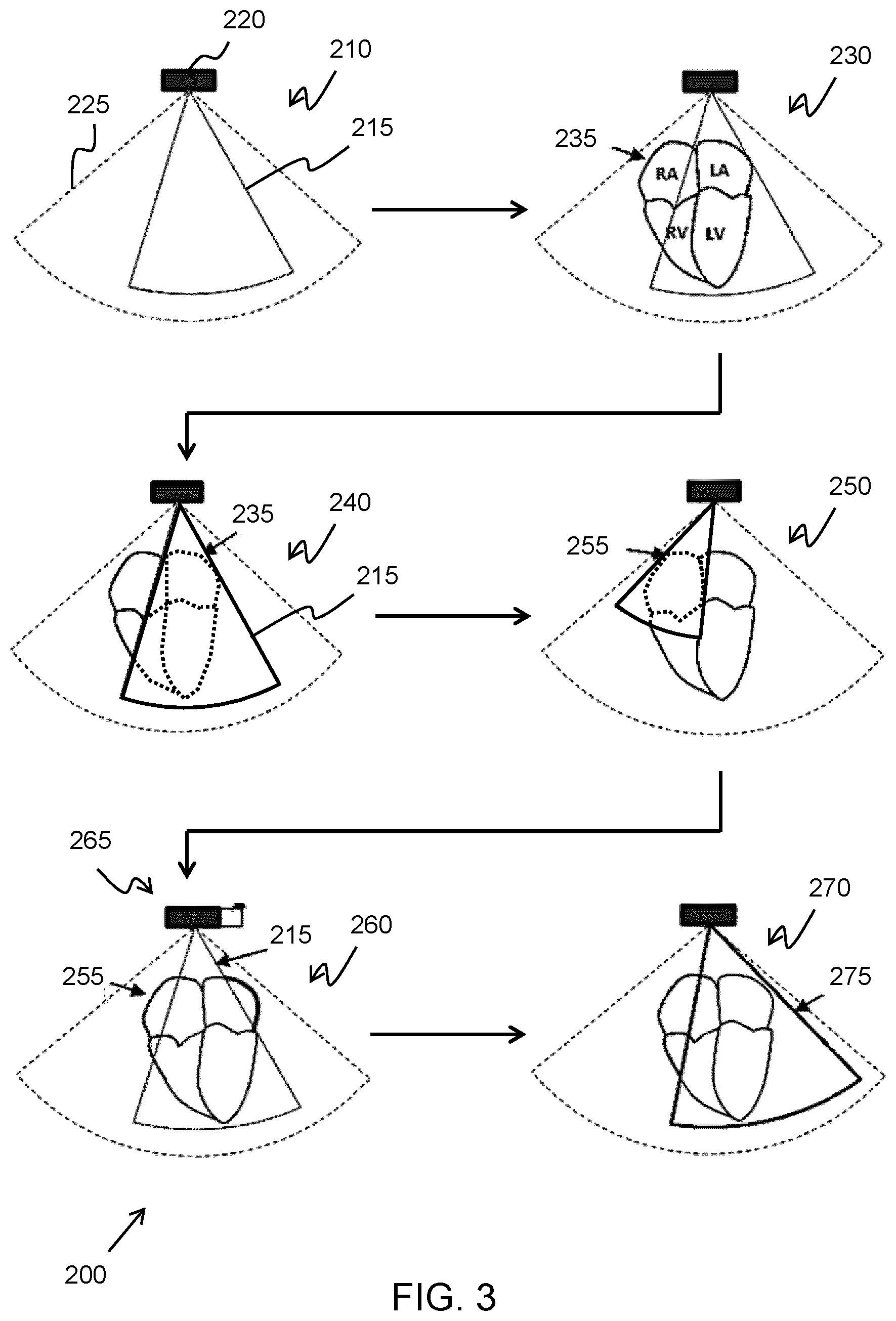 Patent US12102482 Figure 3 – Methods and systems for adjusting the field of view of an ultrasound probe