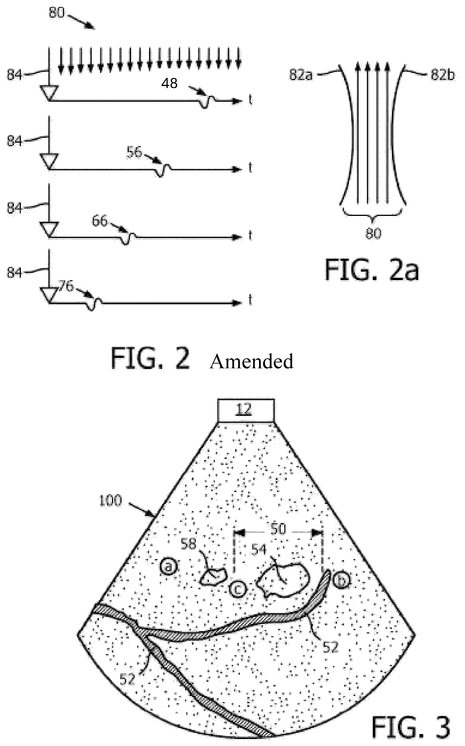 Patent US12102483 Figure 2 – Ultrasonic shearwave imaging with patient-adaptive shearwave generation