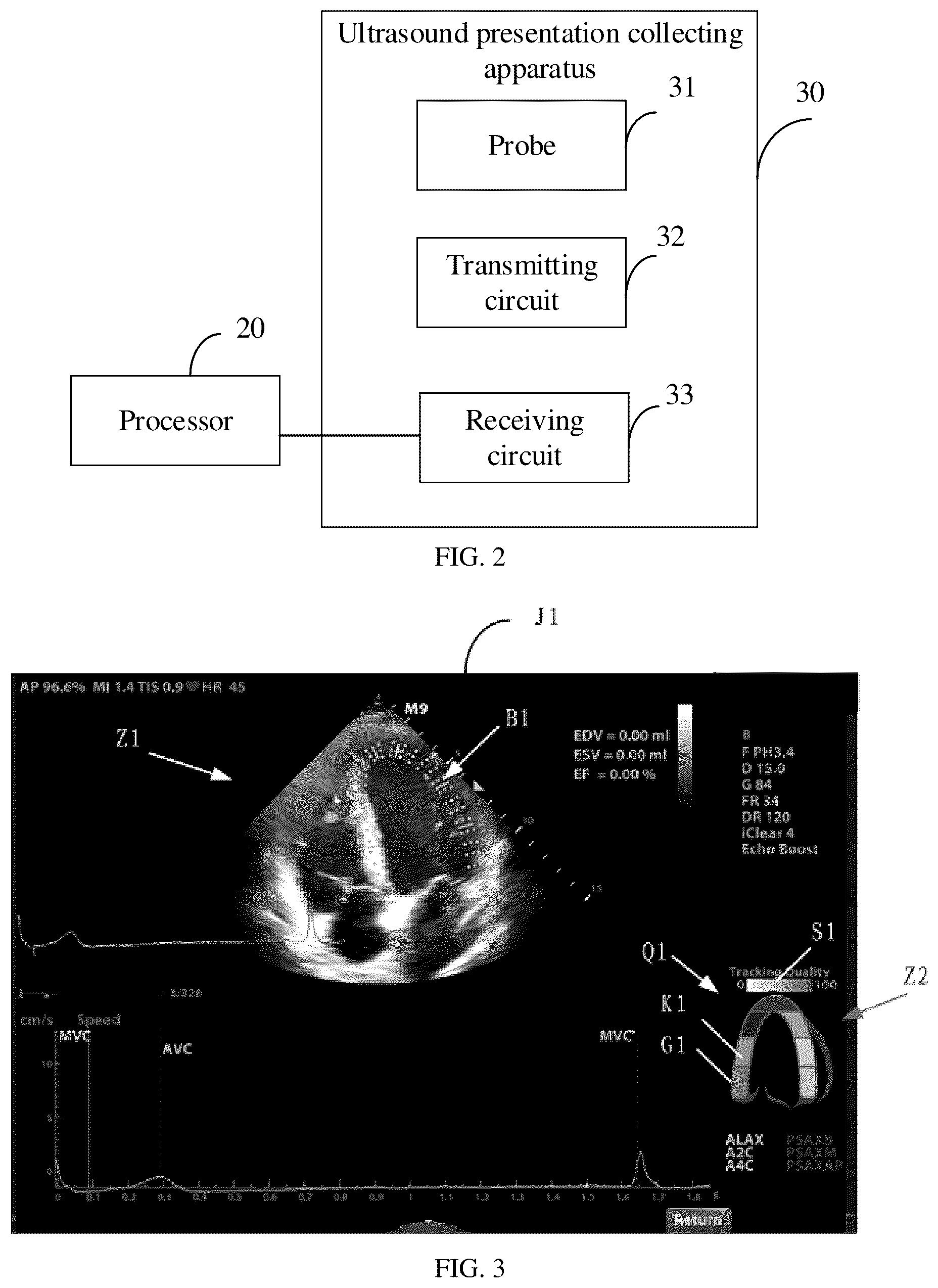 Patent US12102484 Figure 2 – Ultrasound image processing device and method, and computer-readable storage medium