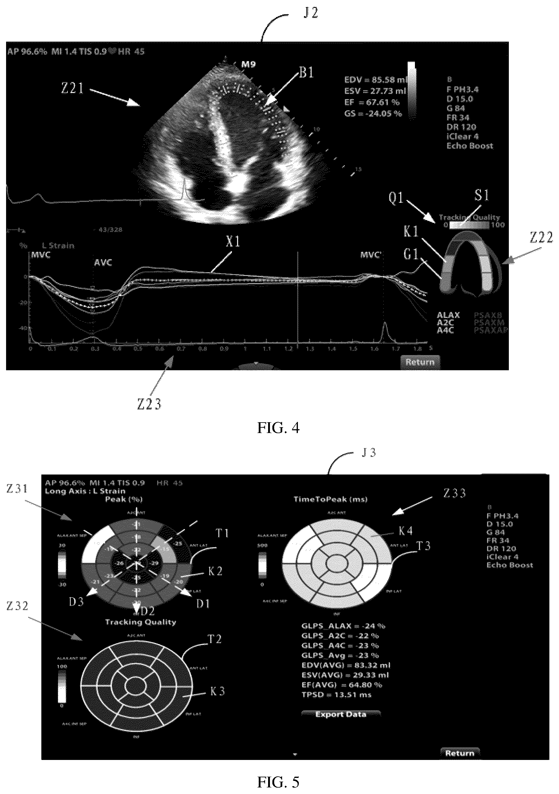 Patent US12102484 Figure 3 – Ultrasound image processing device and method, and computer-readable storage medium