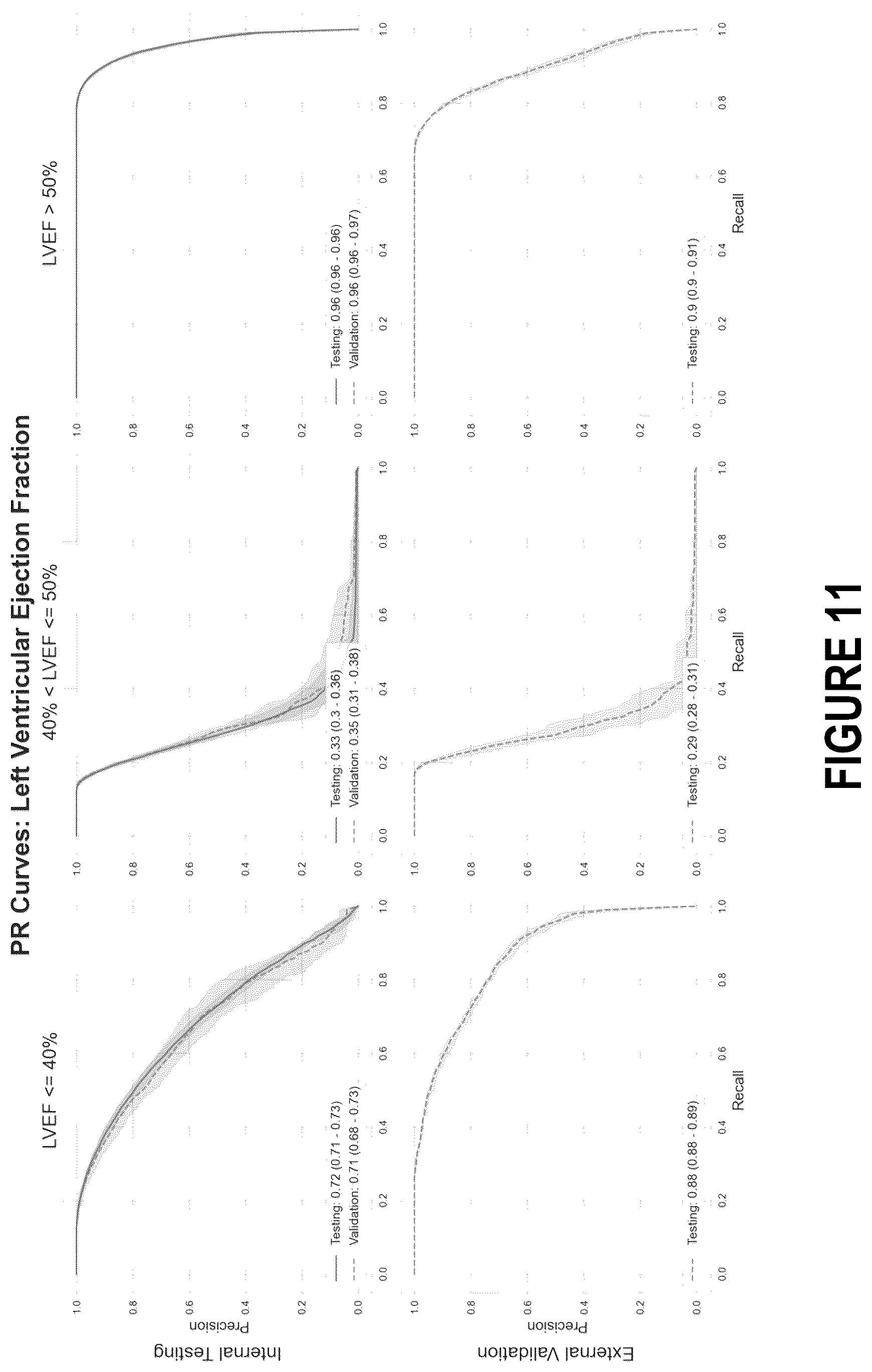 Patent US12102485 Figure 14 – Surfacing insights into left and right ventricular dysfunction through deep learning