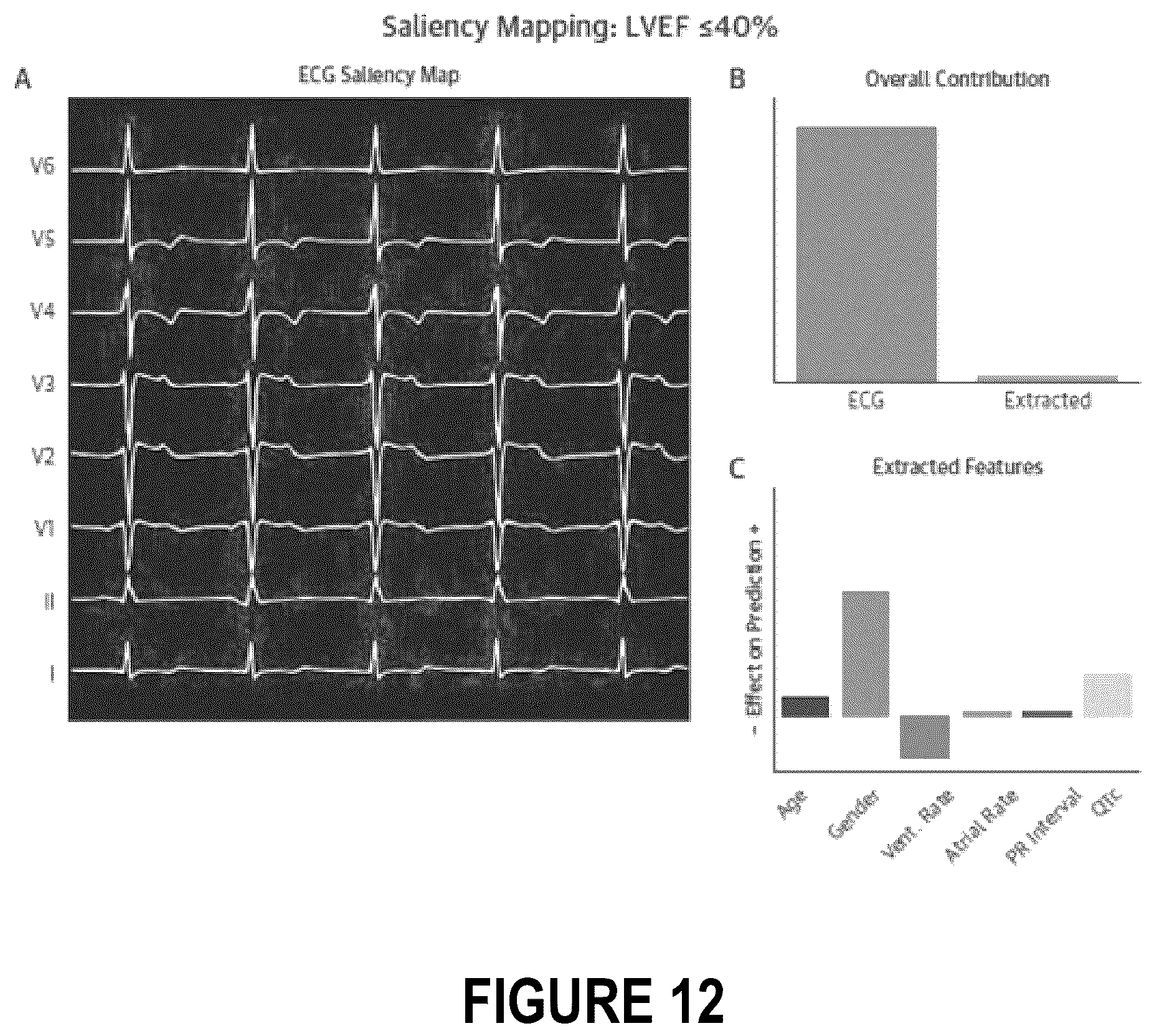 Patent US12102485 Figure 15 – Surfacing insights into left and right ventricular dysfunction through deep learning