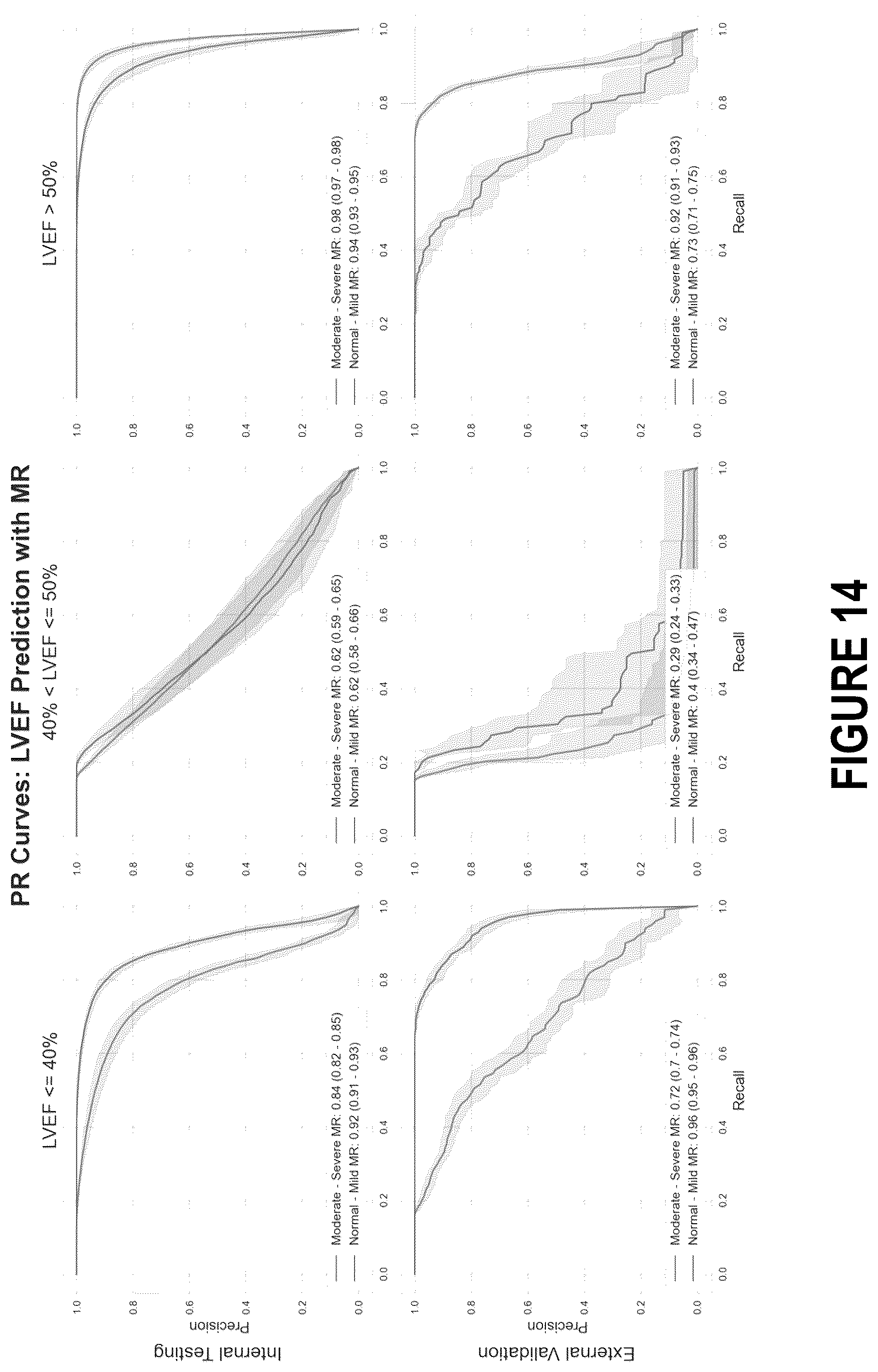 Patent US12102485 Figure 17 – Surfacing insights into left and right ventricular dysfunction through deep learning