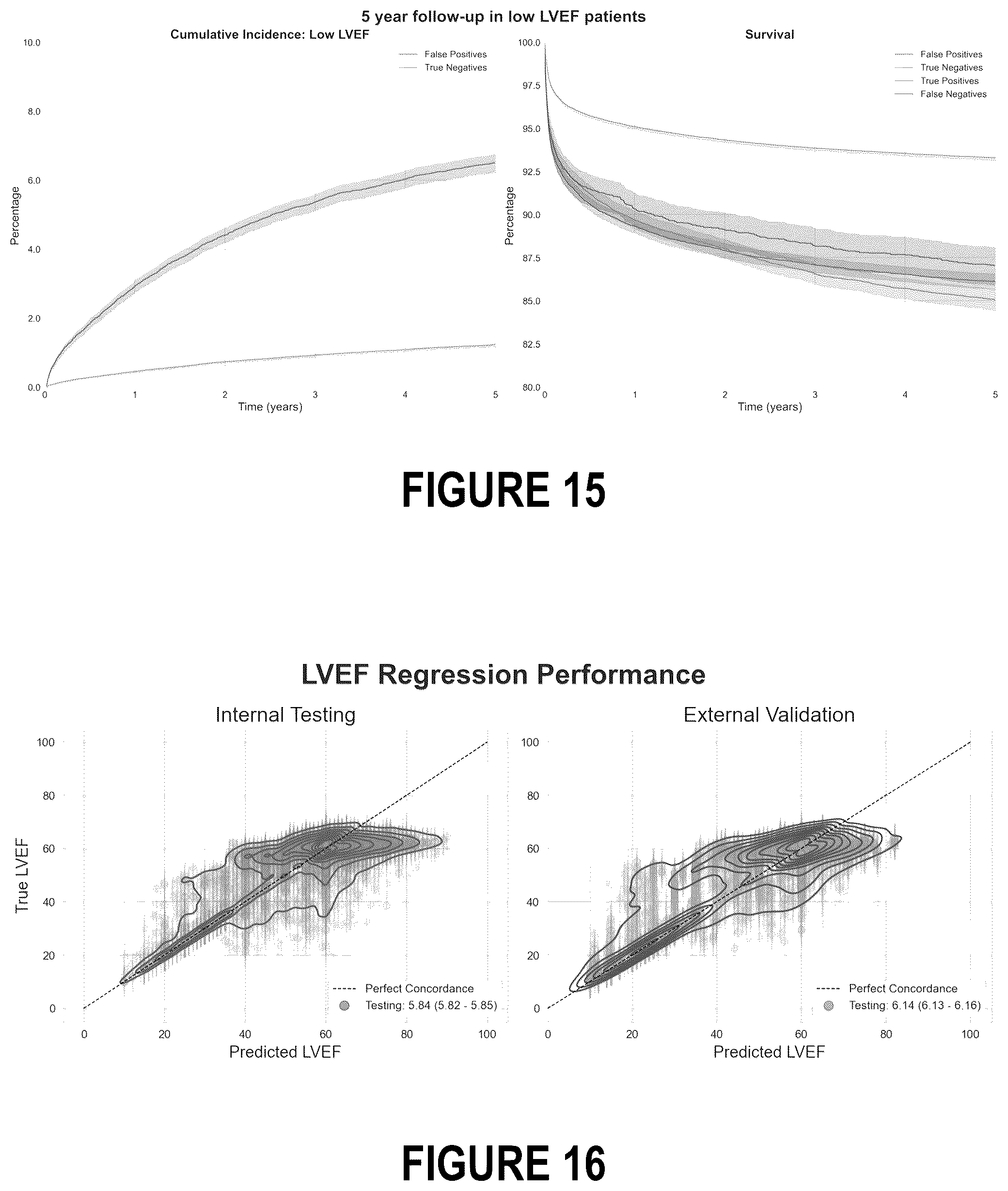 Patent US12102485 Figure 18 – Surfacing insights into left and right ventricular dysfunction through deep learning
