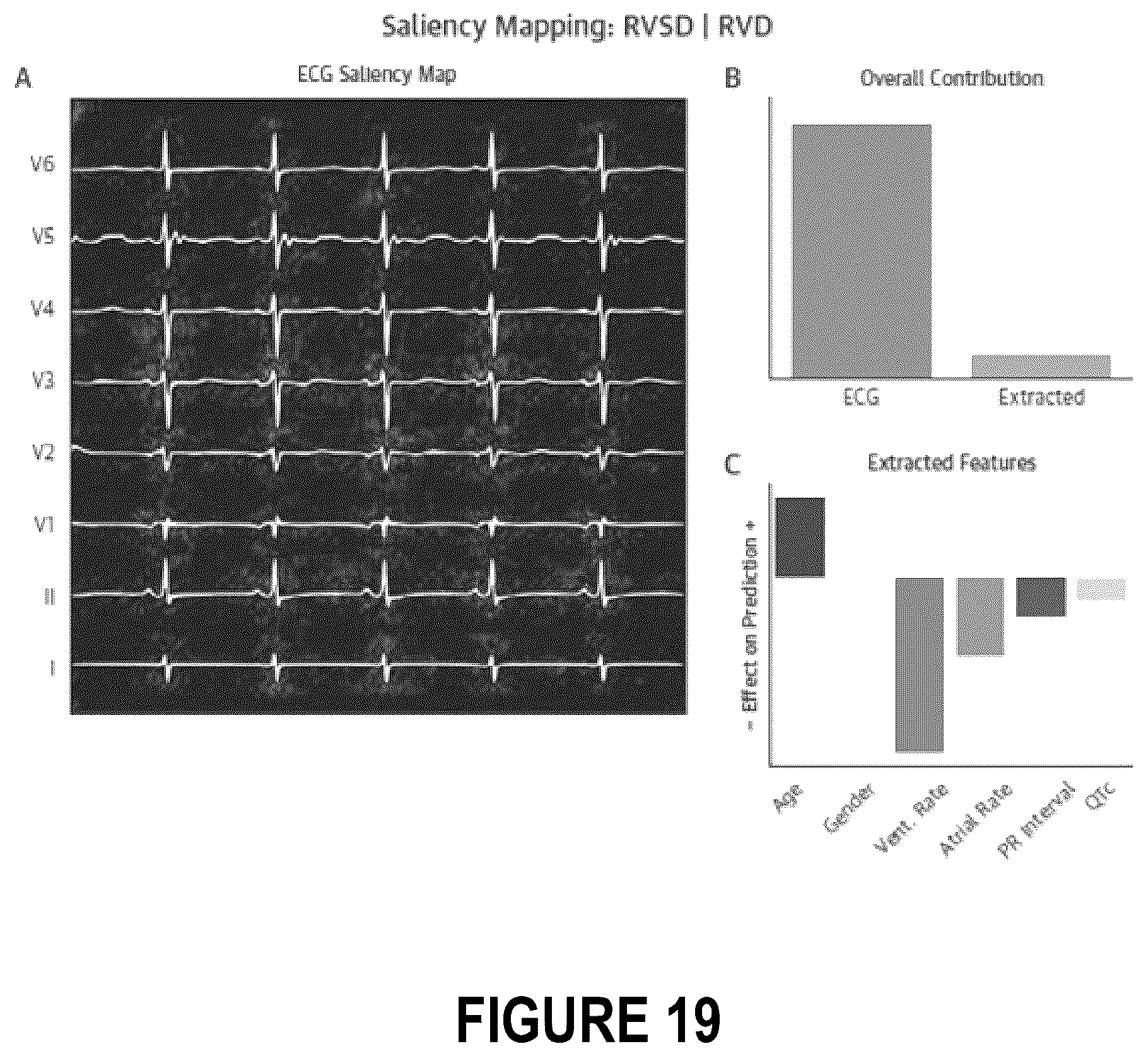 Patent US12102485 Figure 20 – Surfacing insights into left and right ventricular dysfunction through deep learning