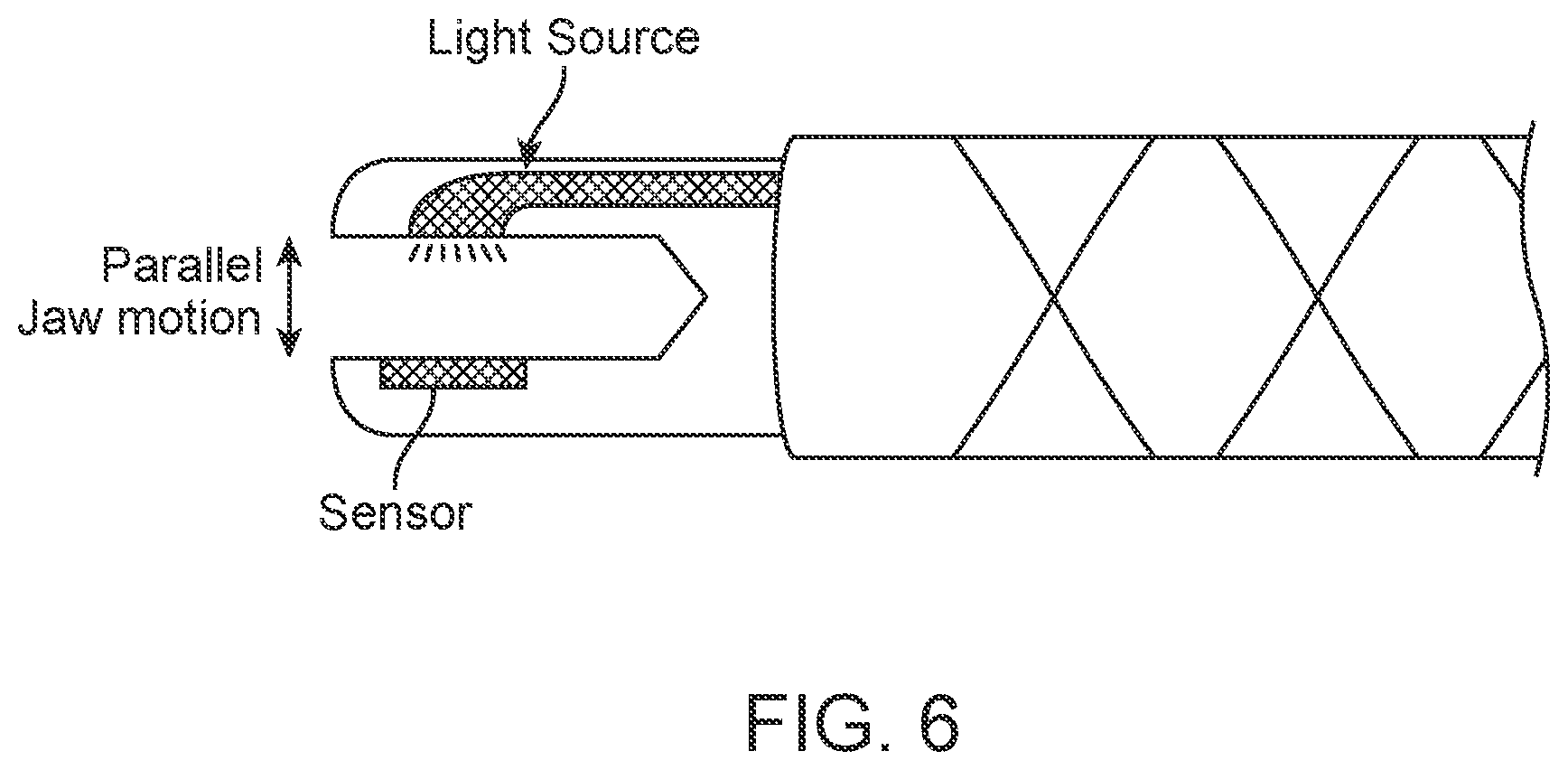 Patent US12102487 Figure 6 – Instrument for optical tissue interrogation