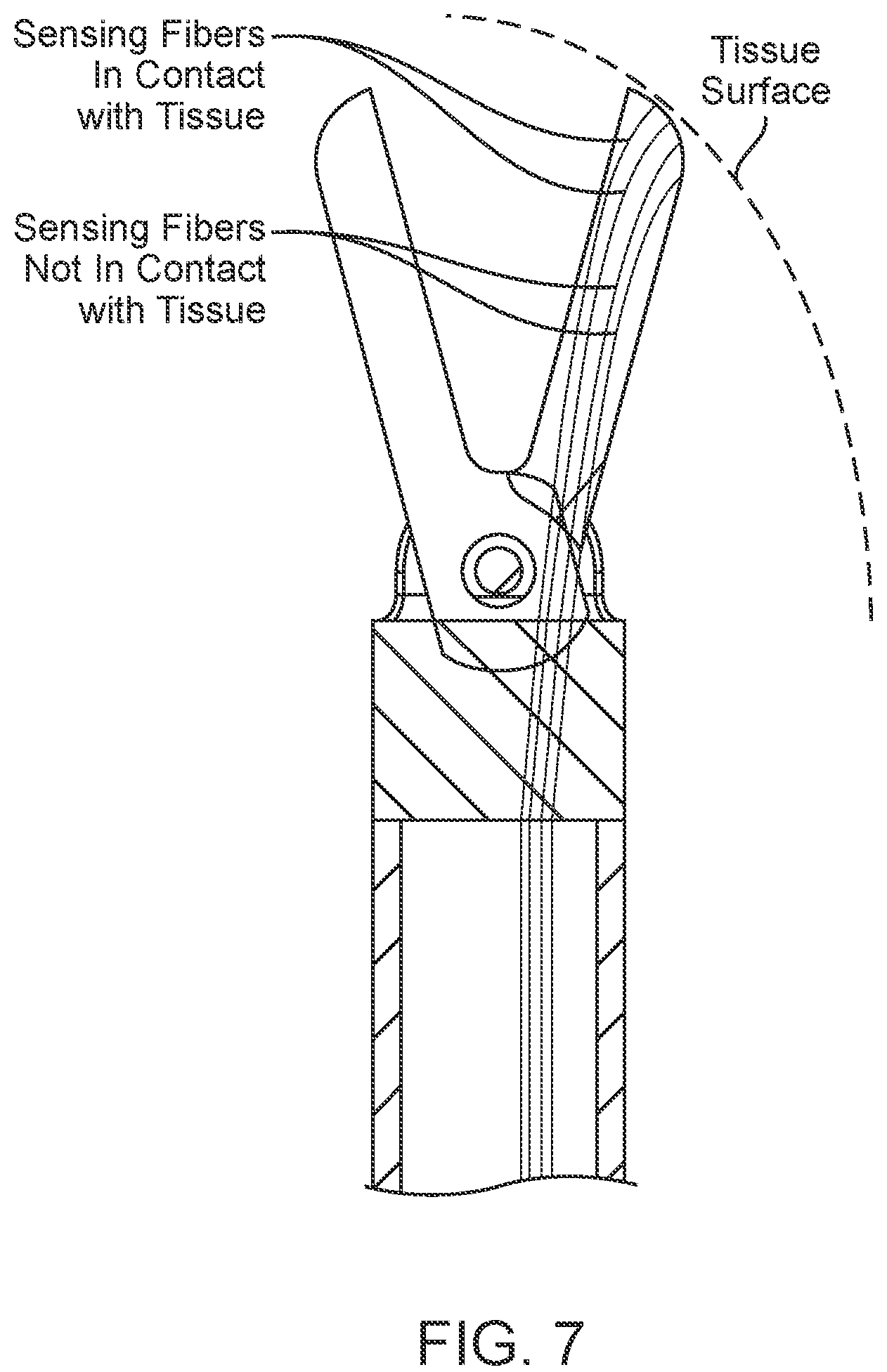 Patent US12102487 Figure 7 – Instrument for optical tissue interrogation