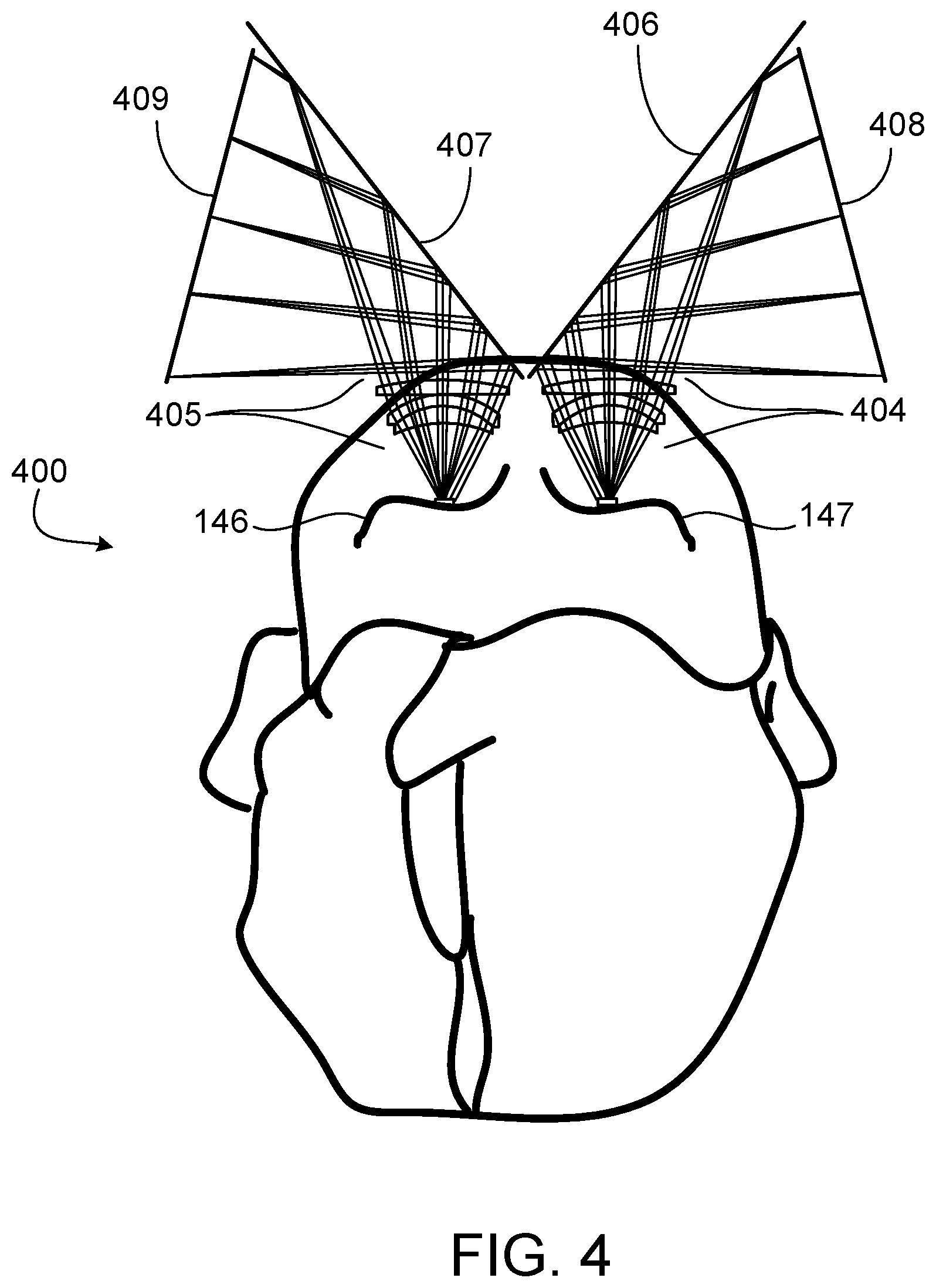 Patent US12102488 Figure 3 – Display with folded optical path
