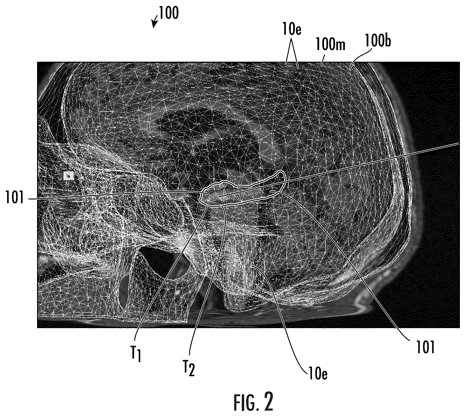 Patent US12102489 Figure 2 – Image-guided surgical systems with quantitative evaluation of in vivo thermal treatments and related methods