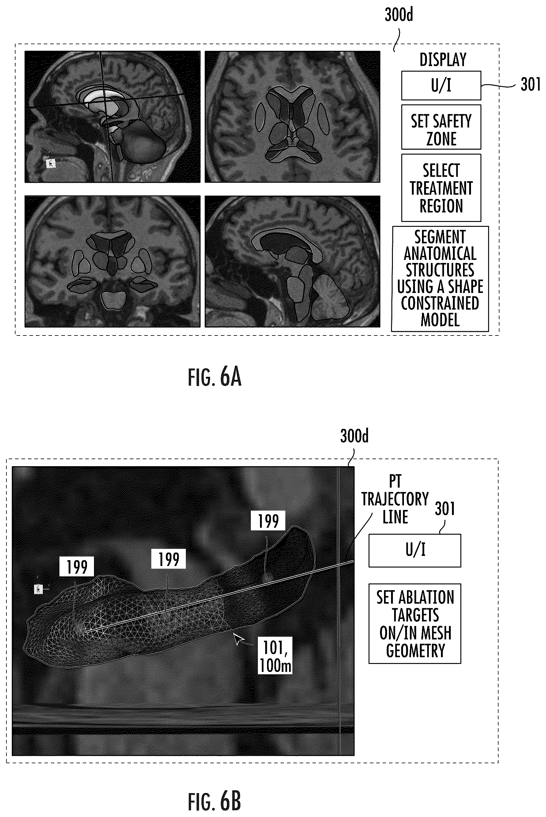Patent US12102489 Figure 6 – Image-guided surgical systems with quantitative evaluation of in vivo thermal treatments and related methods