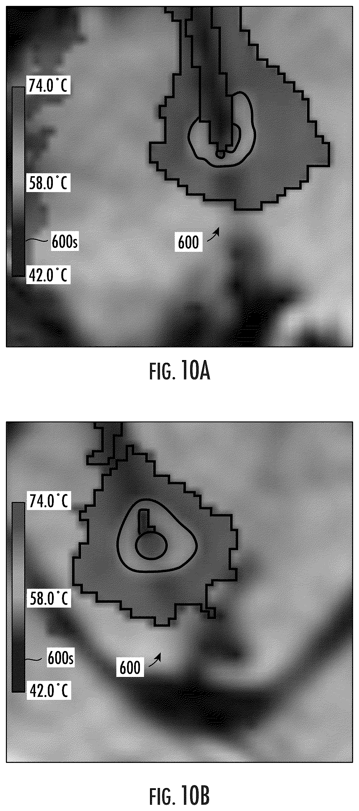 Patent US12102489 Figure 12 – Image-guided surgical systems with quantitative evaluation of in vivo thermal treatments and related methods