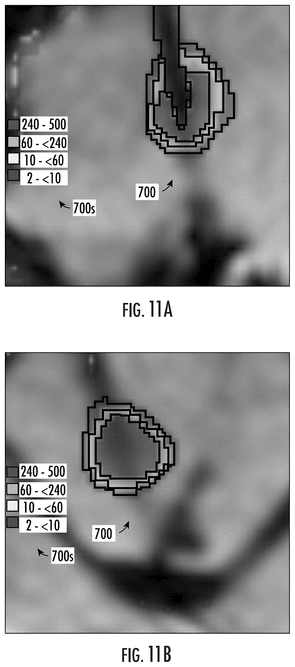 Patent US12102489 Figure 13 – Image-guided surgical systems with quantitative evaluation of in vivo thermal treatments and related methods