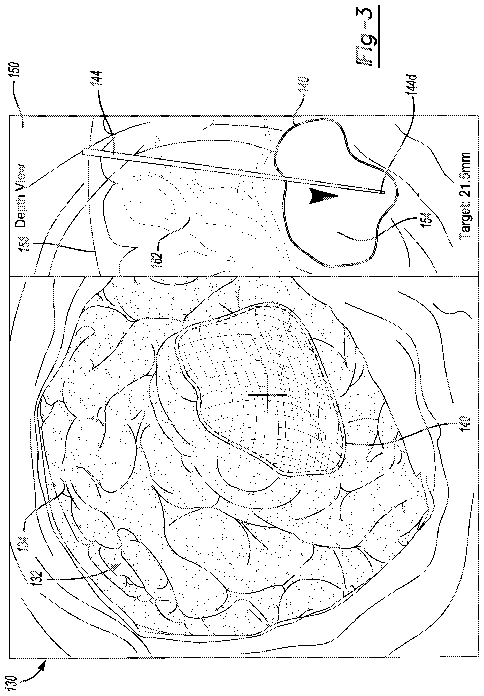Patent US12102490 Figure 3 – System and method for viewing a subject