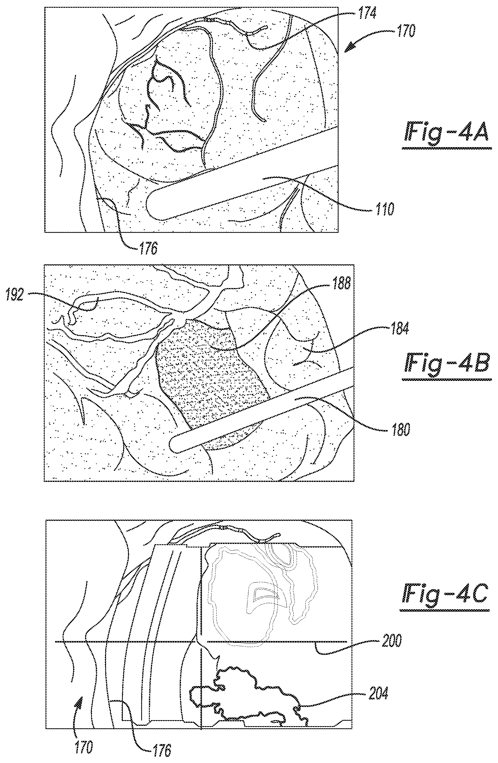 Patent US12102490 Figure 4 – System and method for viewing a subject