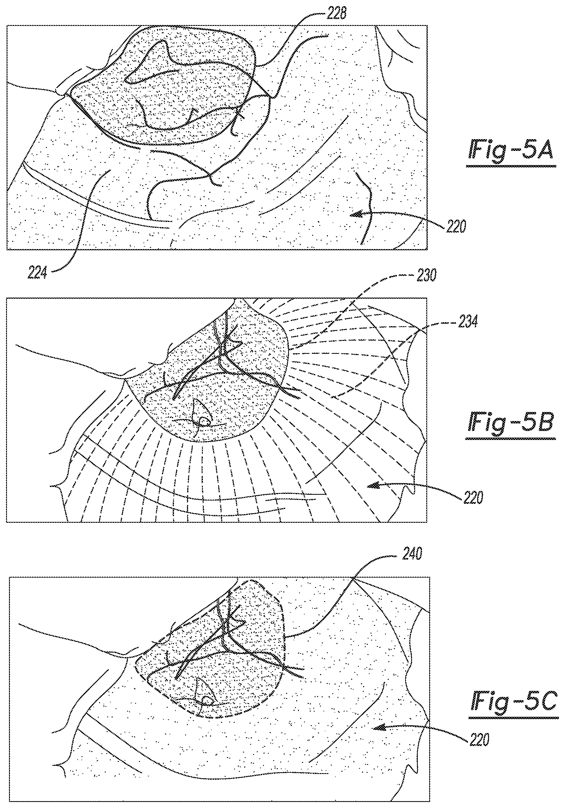 Patent US12102490 Figure 5 – System and method for viewing a subject