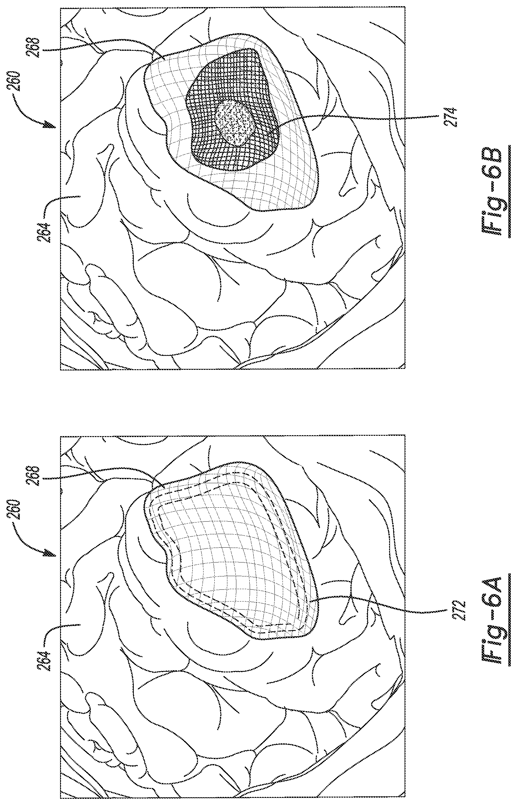 Patent US12102490 Figure 6 – System and method for viewing a subject