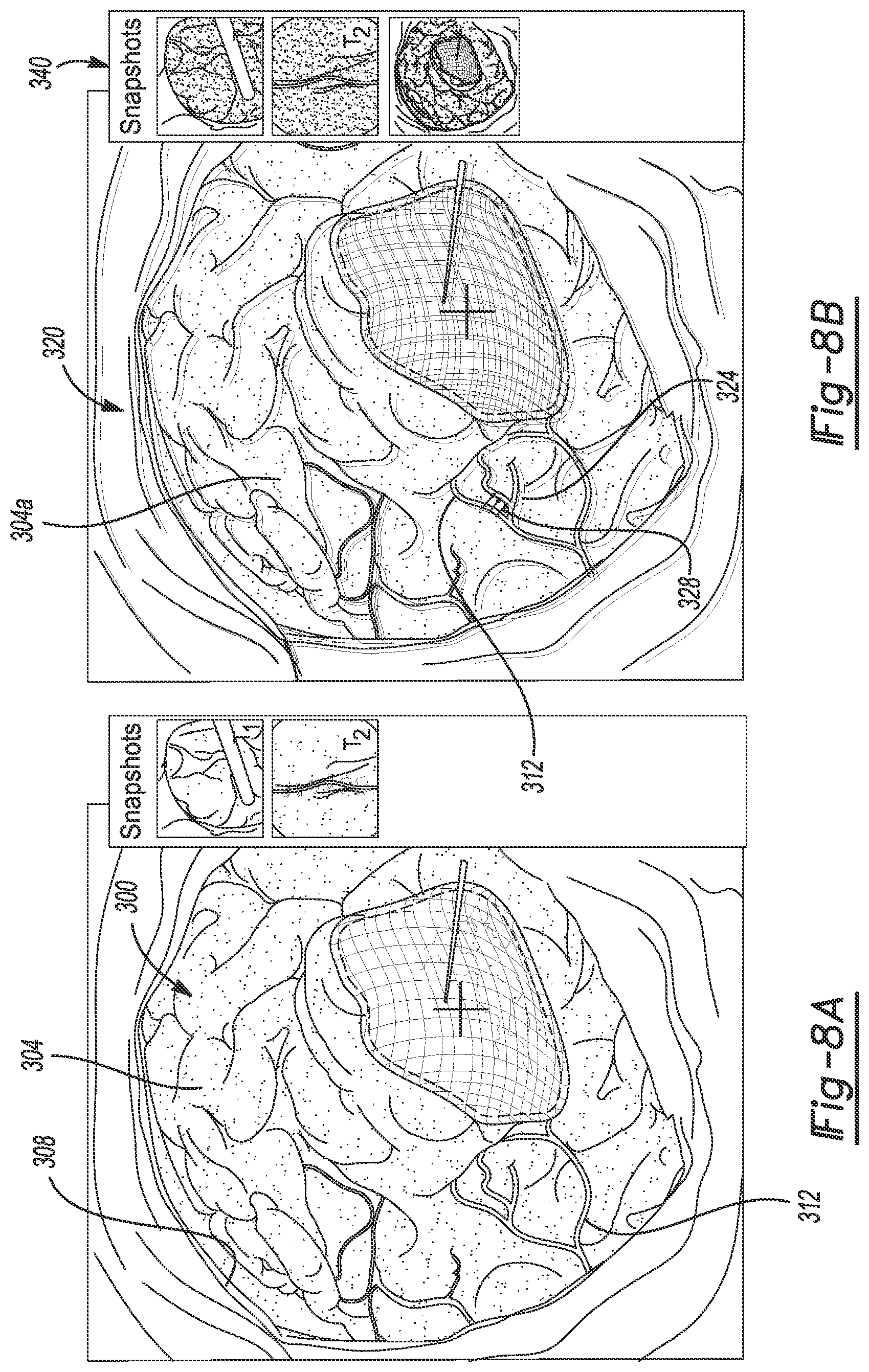 Patent US12102490 Figure 8 – System and method for viewing a subject