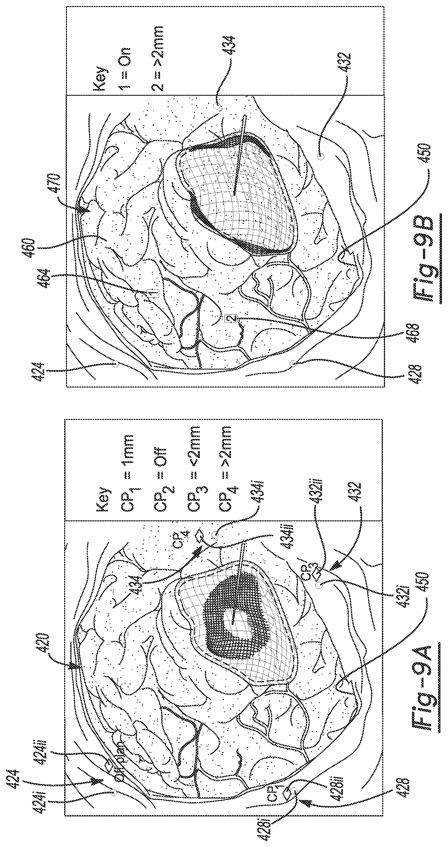 Patent US12102490 Figure 9 – System and method for viewing a subject