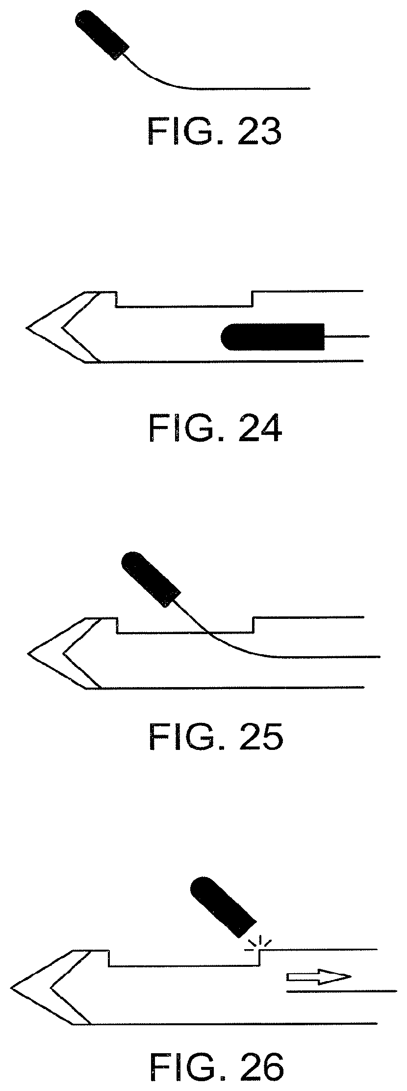 Patent US12102491 Figure 6 – Biopsy marker